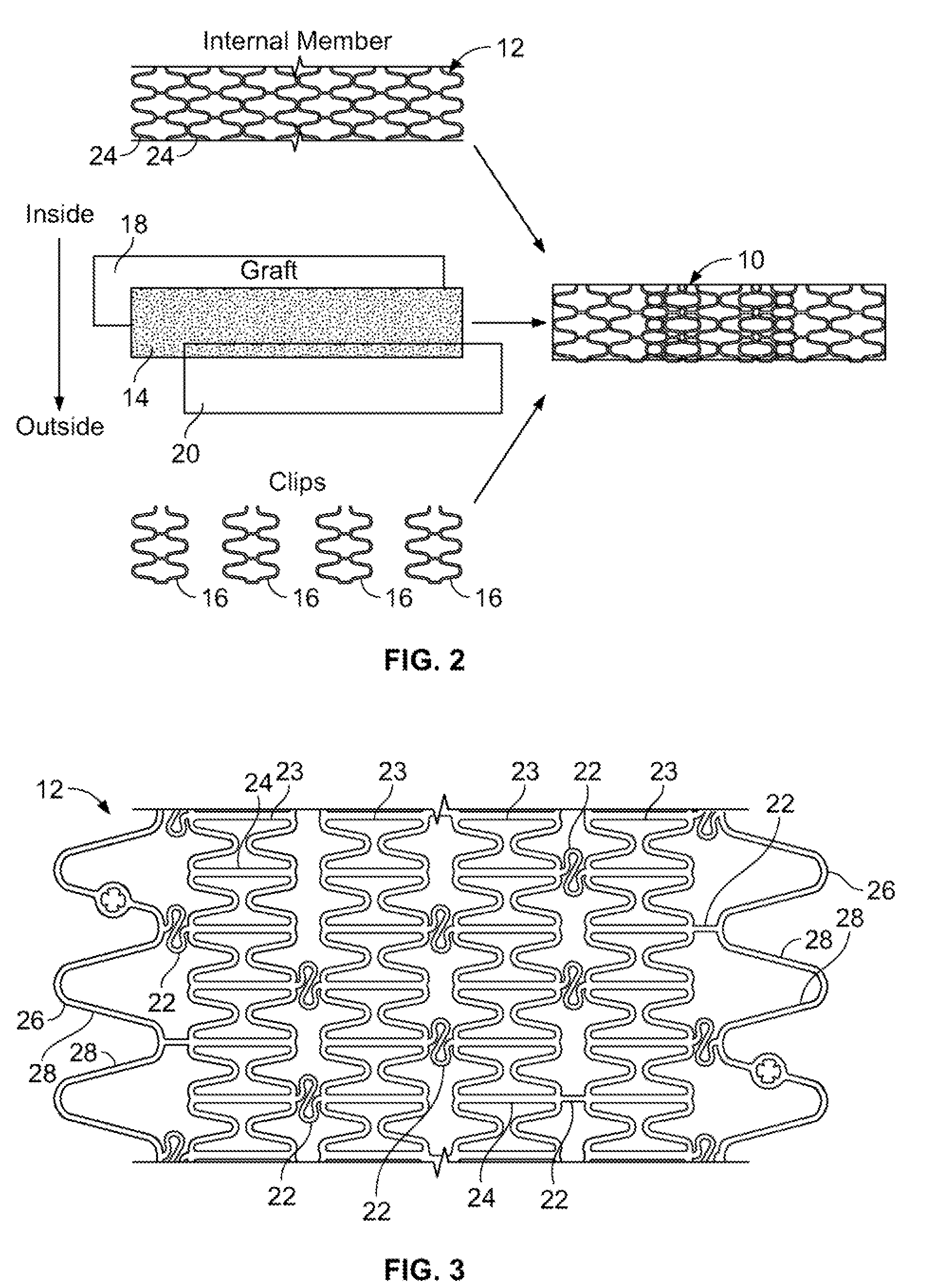 Anti-restenotic therapeutic device