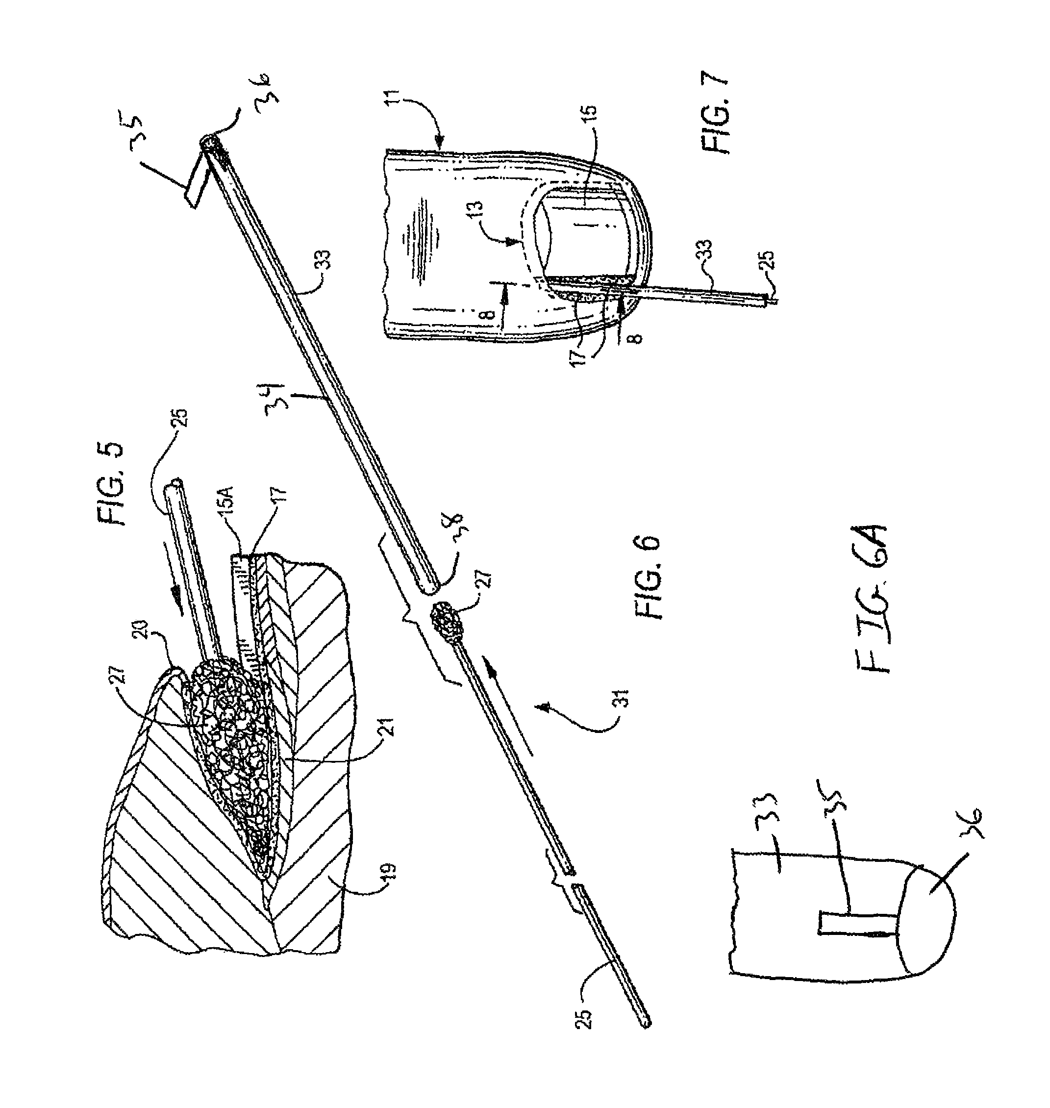 Device and method of treating a nail condition