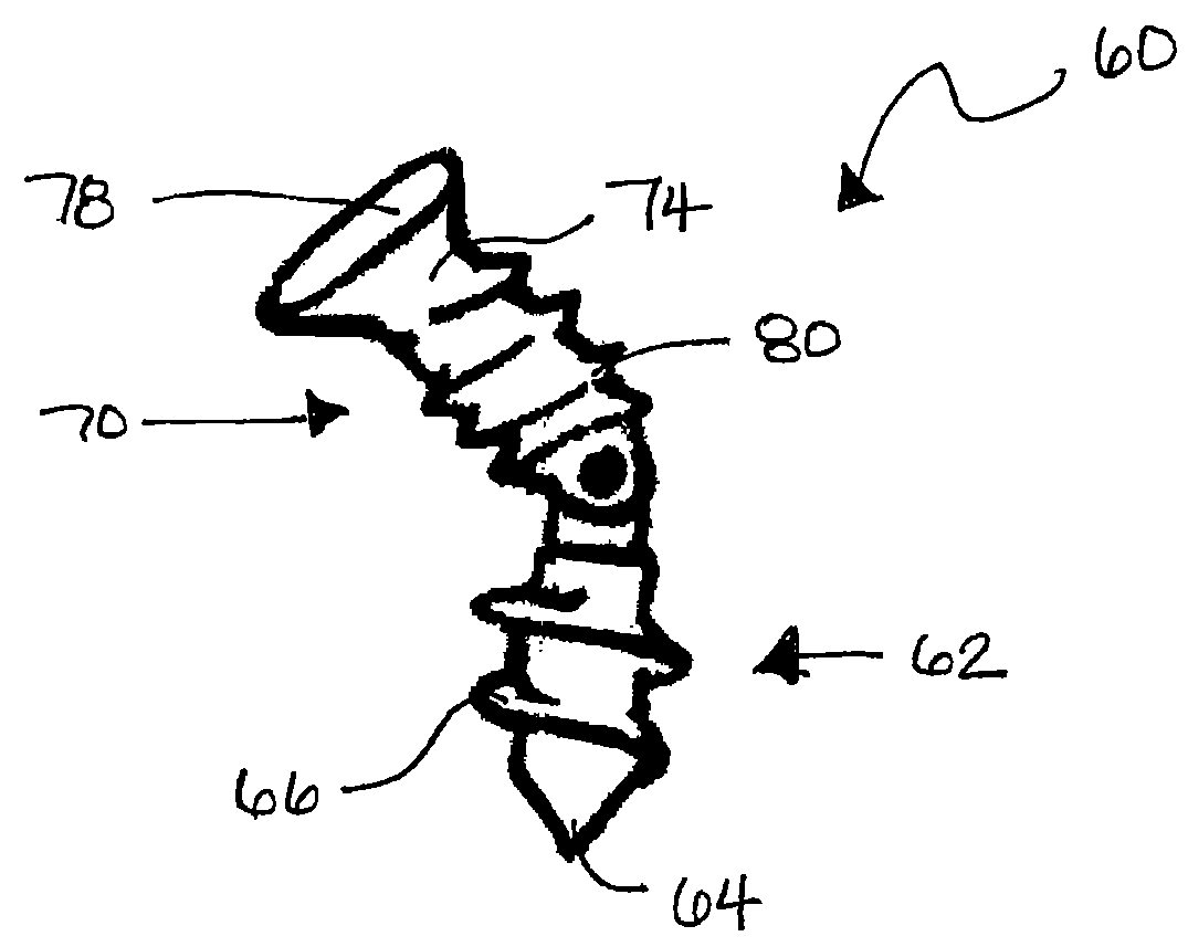 Articulating facet fusion screw