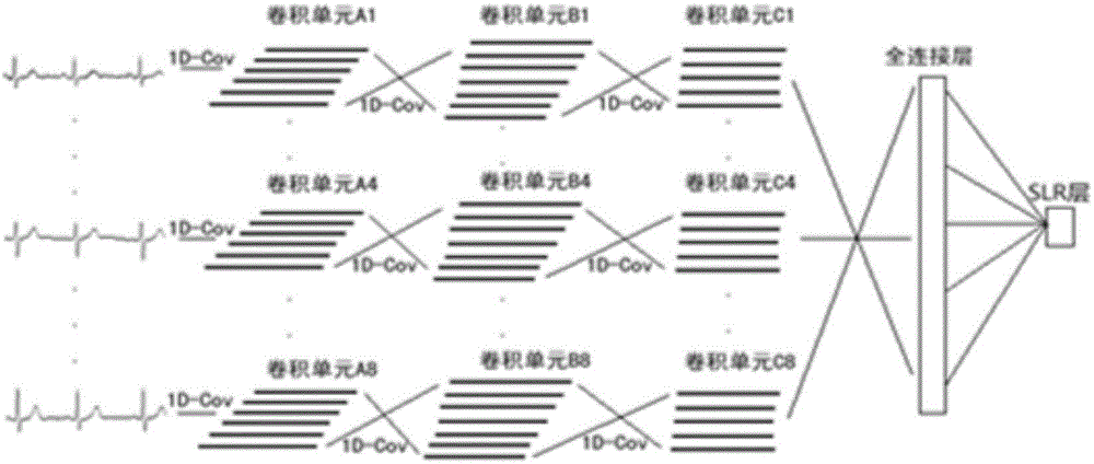 Electrocardiogram classification method and system