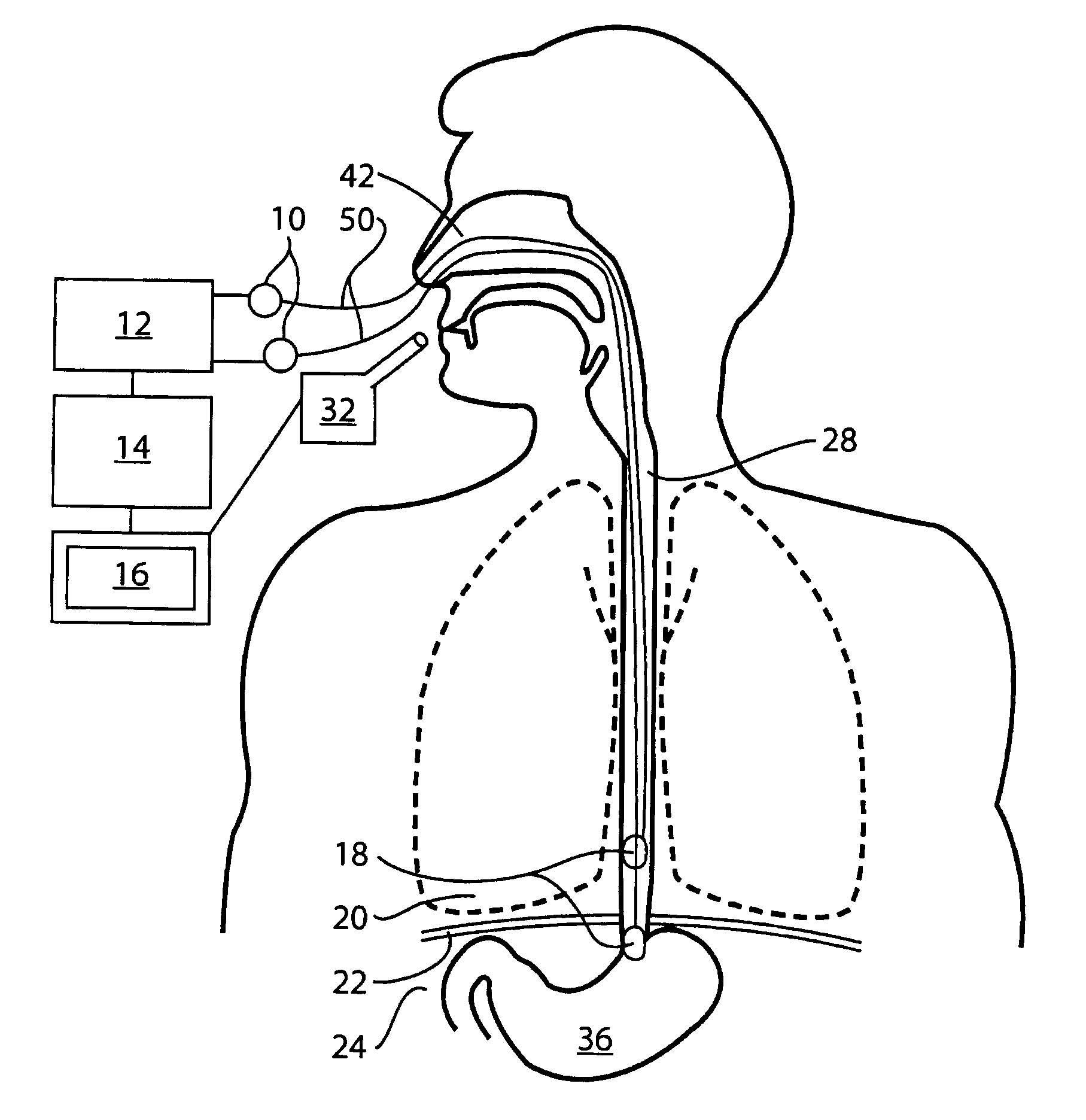 Relative contribution of thoracic muscles to breathing