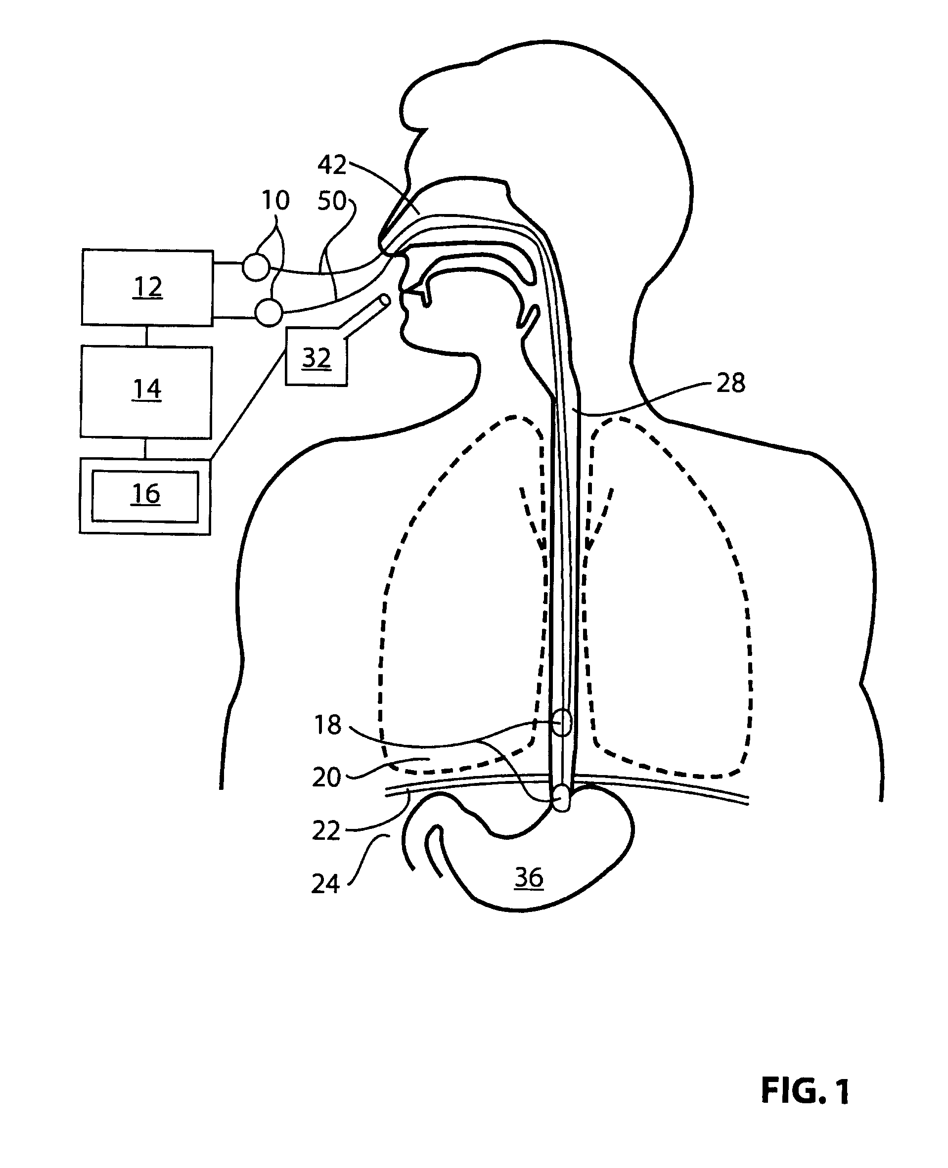 Relative contribution of thoracic muscles to breathing