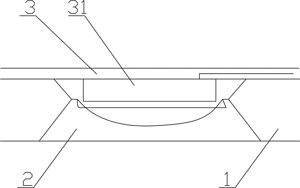 Vibration locating orthopedic steel plate