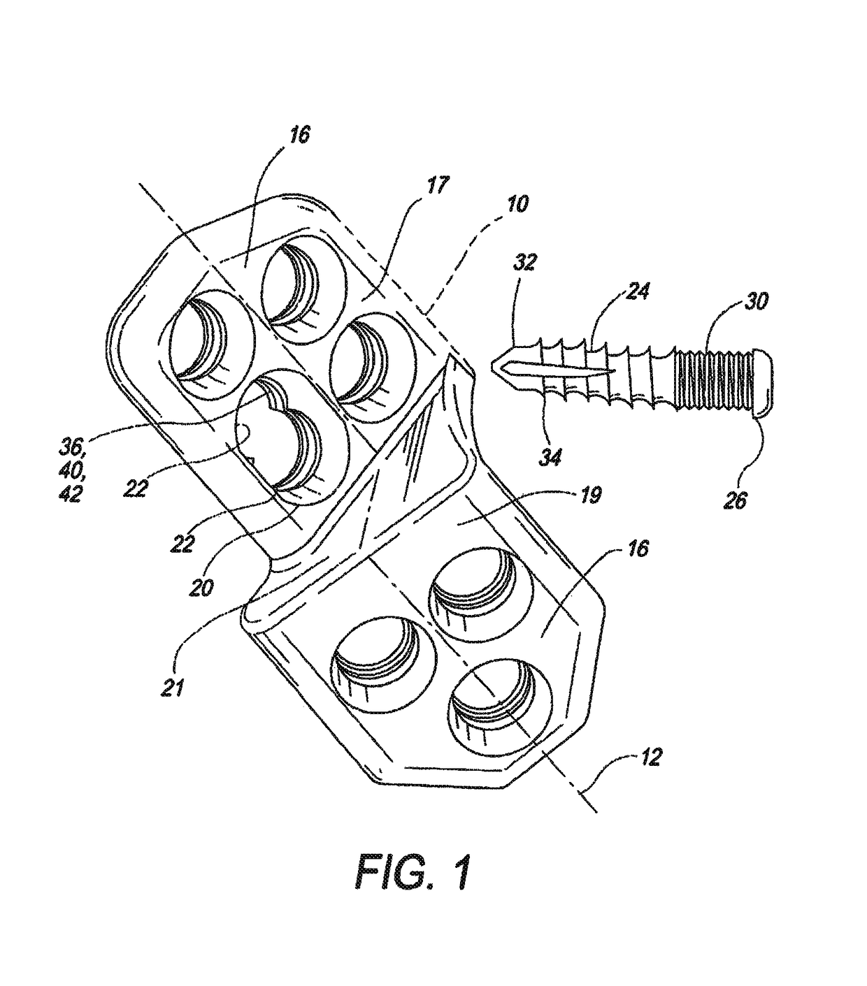 Locking triple pelvic osteotomy plate and method of use