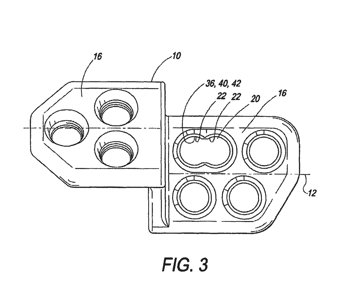 Locking triple pelvic osteotomy plate and method of use