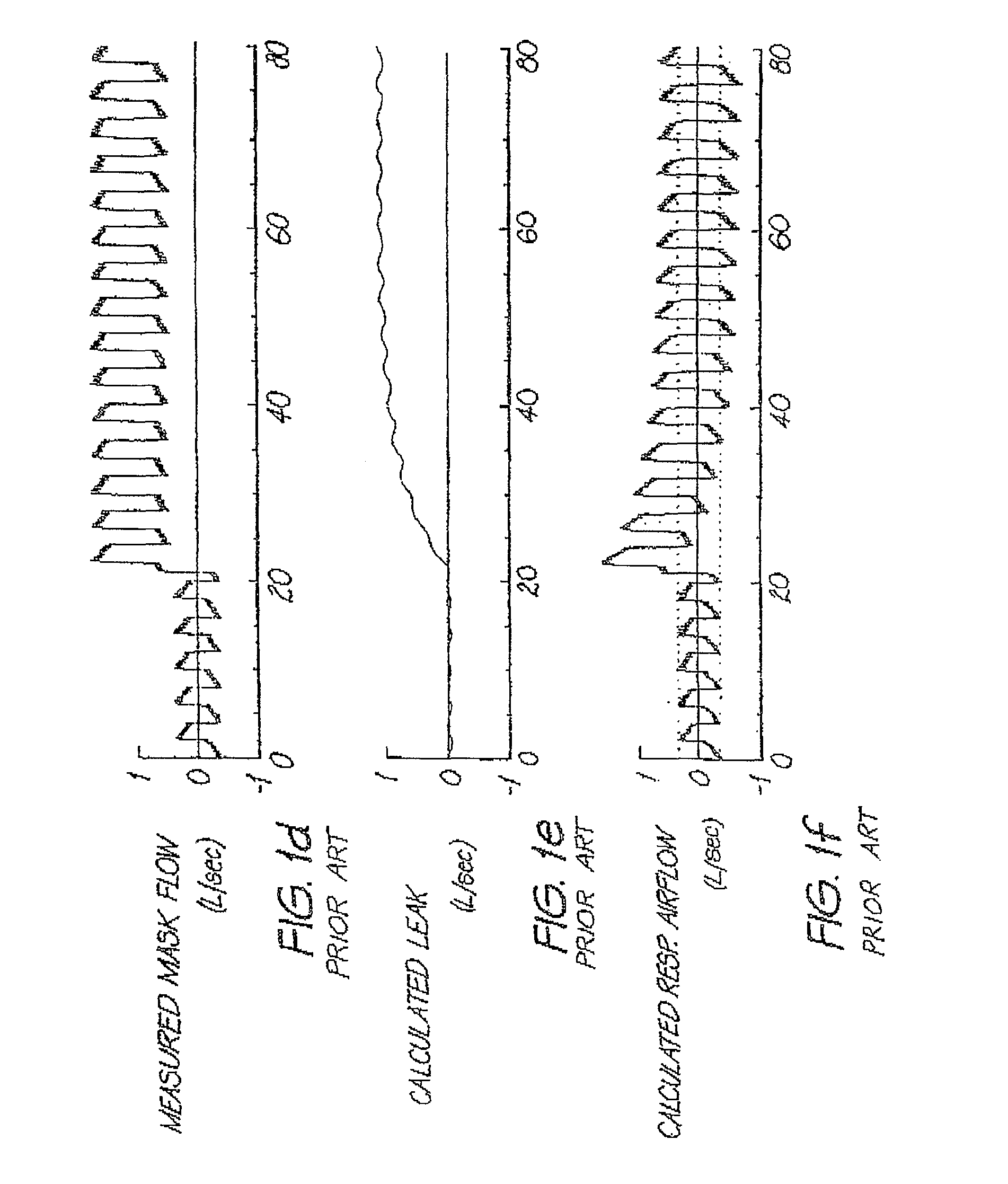 Determination of leak during CPAP treatment