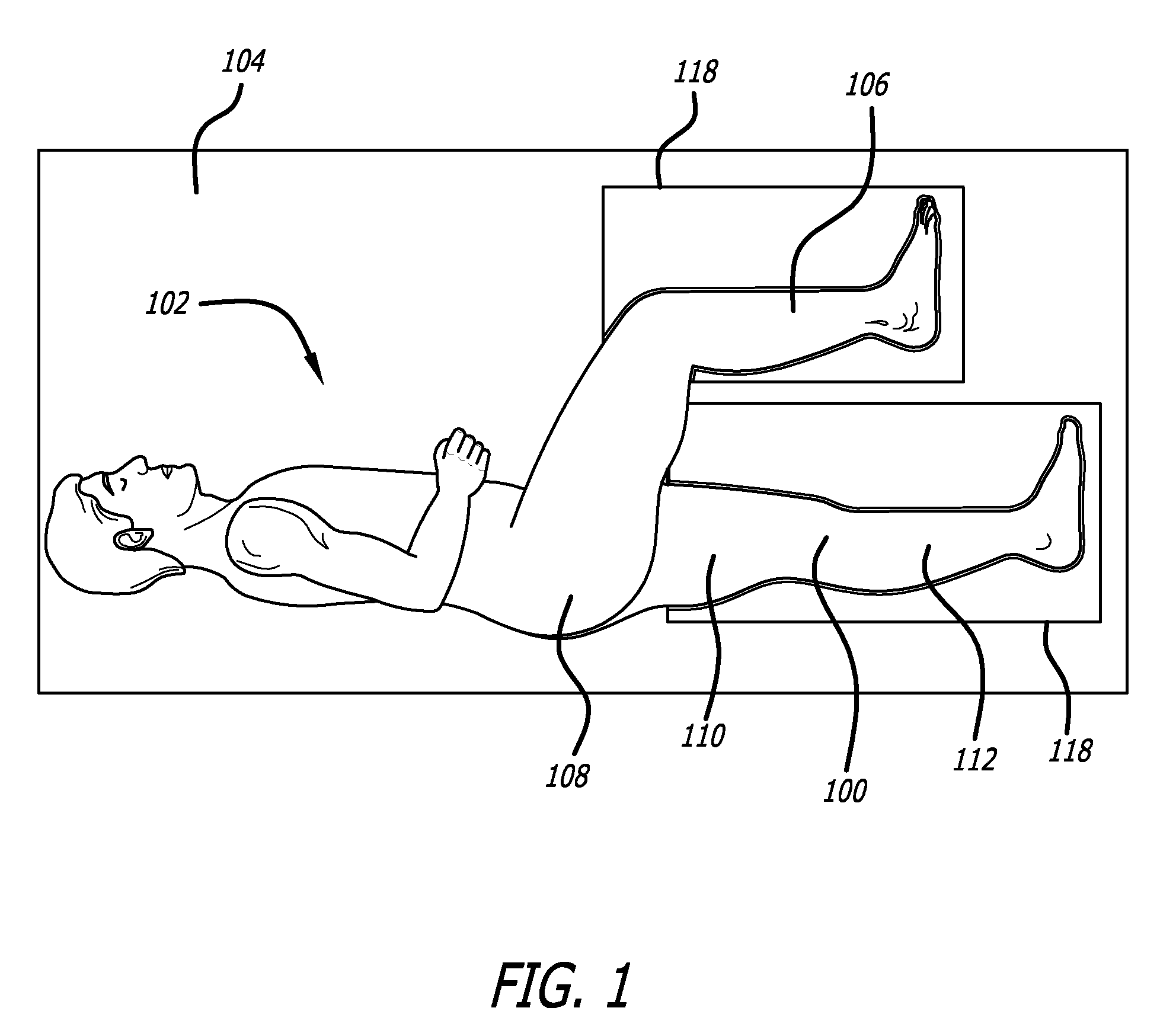 Surgical implantation method and devices for an extra-articular mechanical energy absorbing apparatus