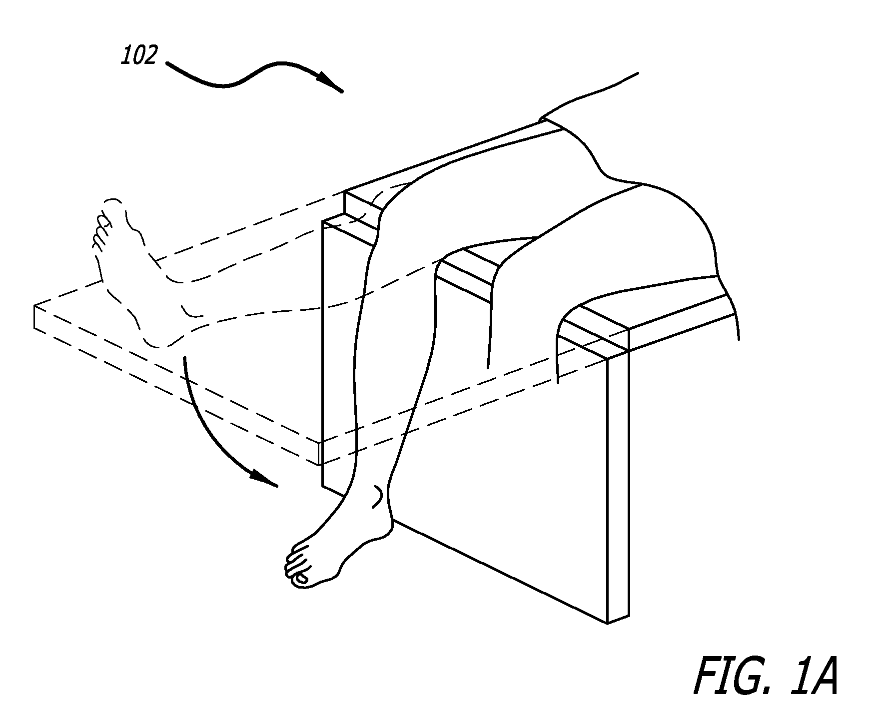 Surgical implantation method and devices for an extra-articular mechanical energy absorbing apparatus