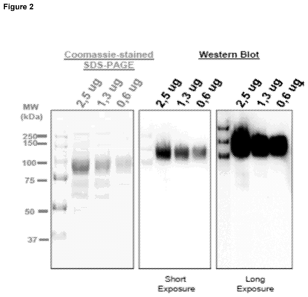 Therapeutic vaccine for Hepatitis b virus (HBV) using the HBV PreS1 and/or PreS2, and/or s-HBsAg regions of the HBV envelope protein