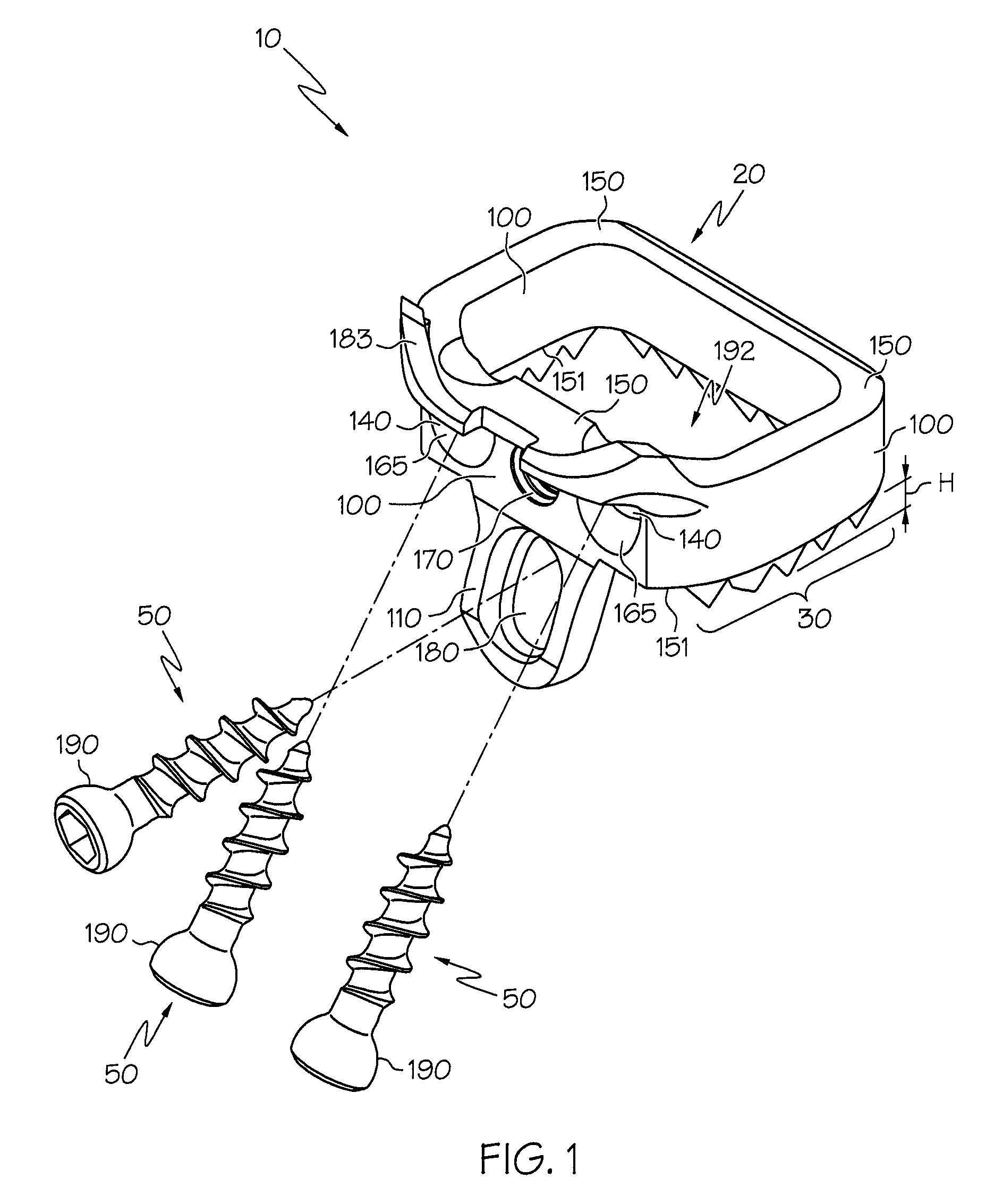 Spine implants