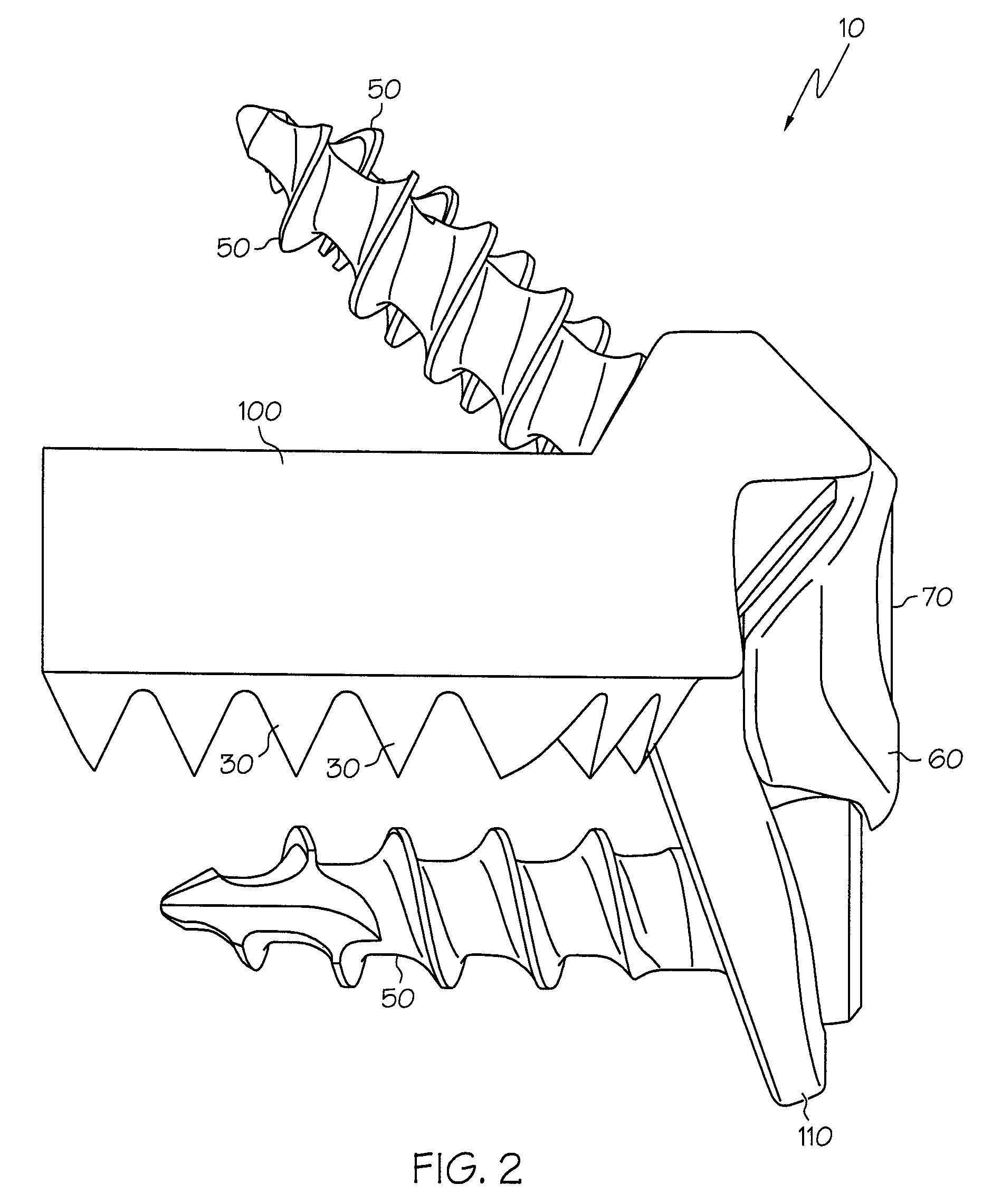 Spine implants