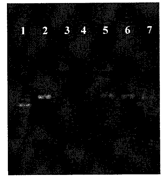 Kit for detecting two pathogenic mutation loci in TAB2 gene of human congenital heart disease, and PCR (Polymerase Chain Reaction) amplification method thereof