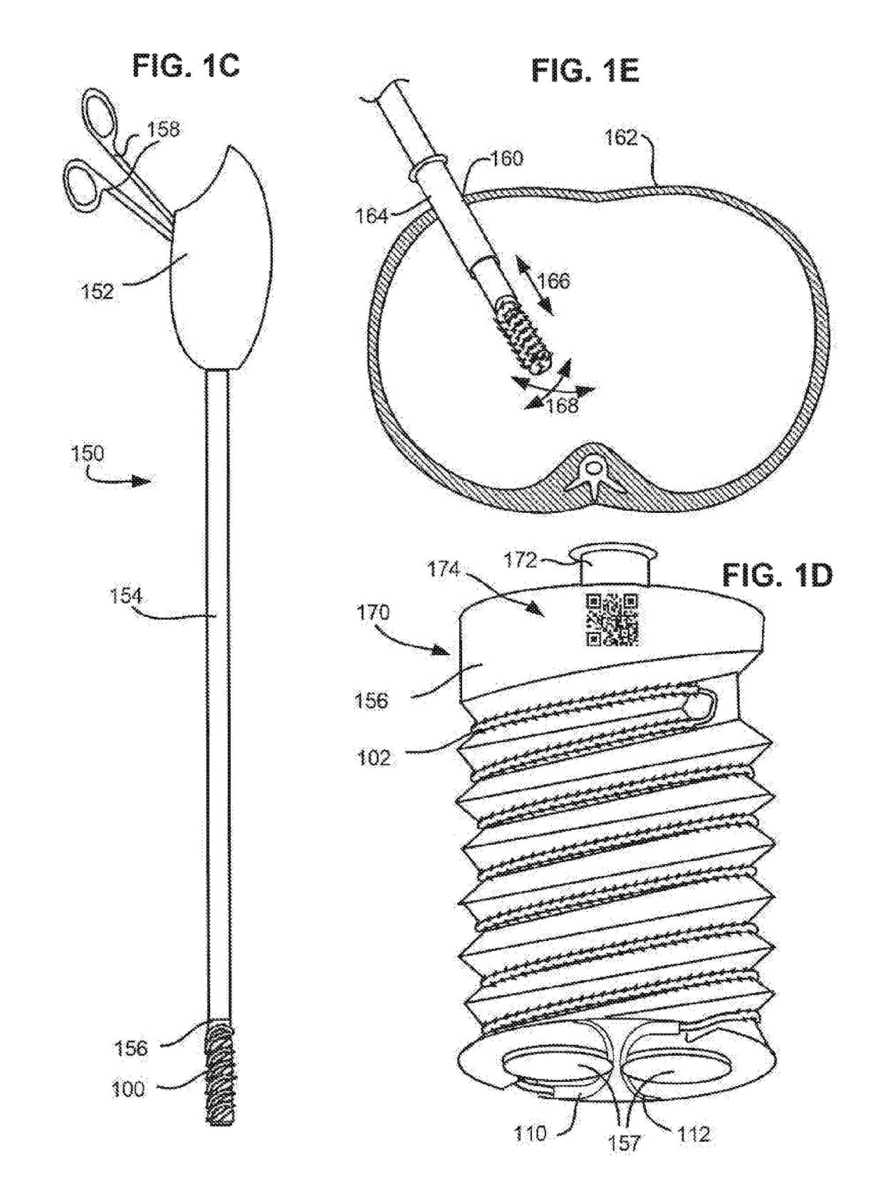 Suture delivery tools for endoscopic and robot-assisted surgery and methods