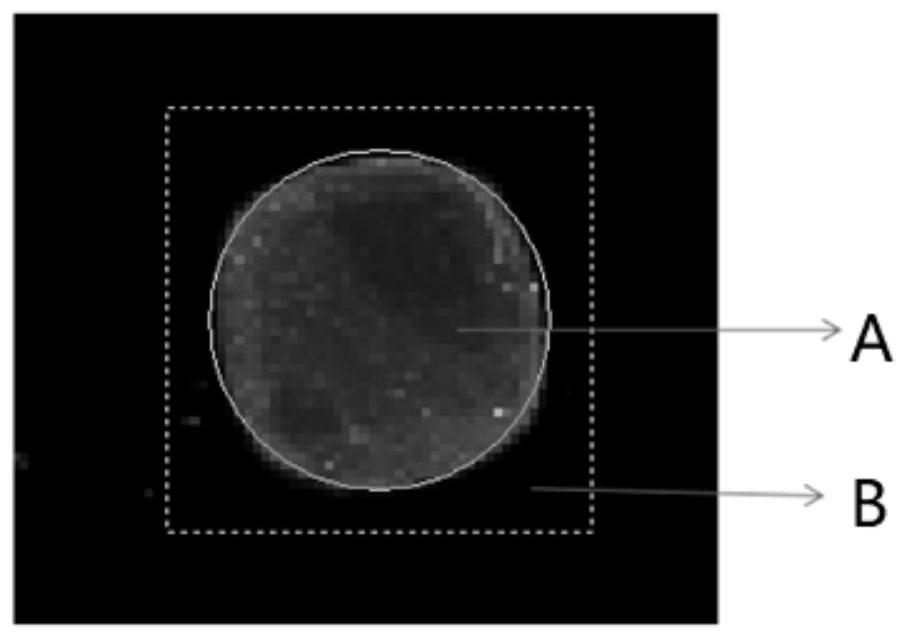 Tool and system for testing papillary thyroid carcinoma