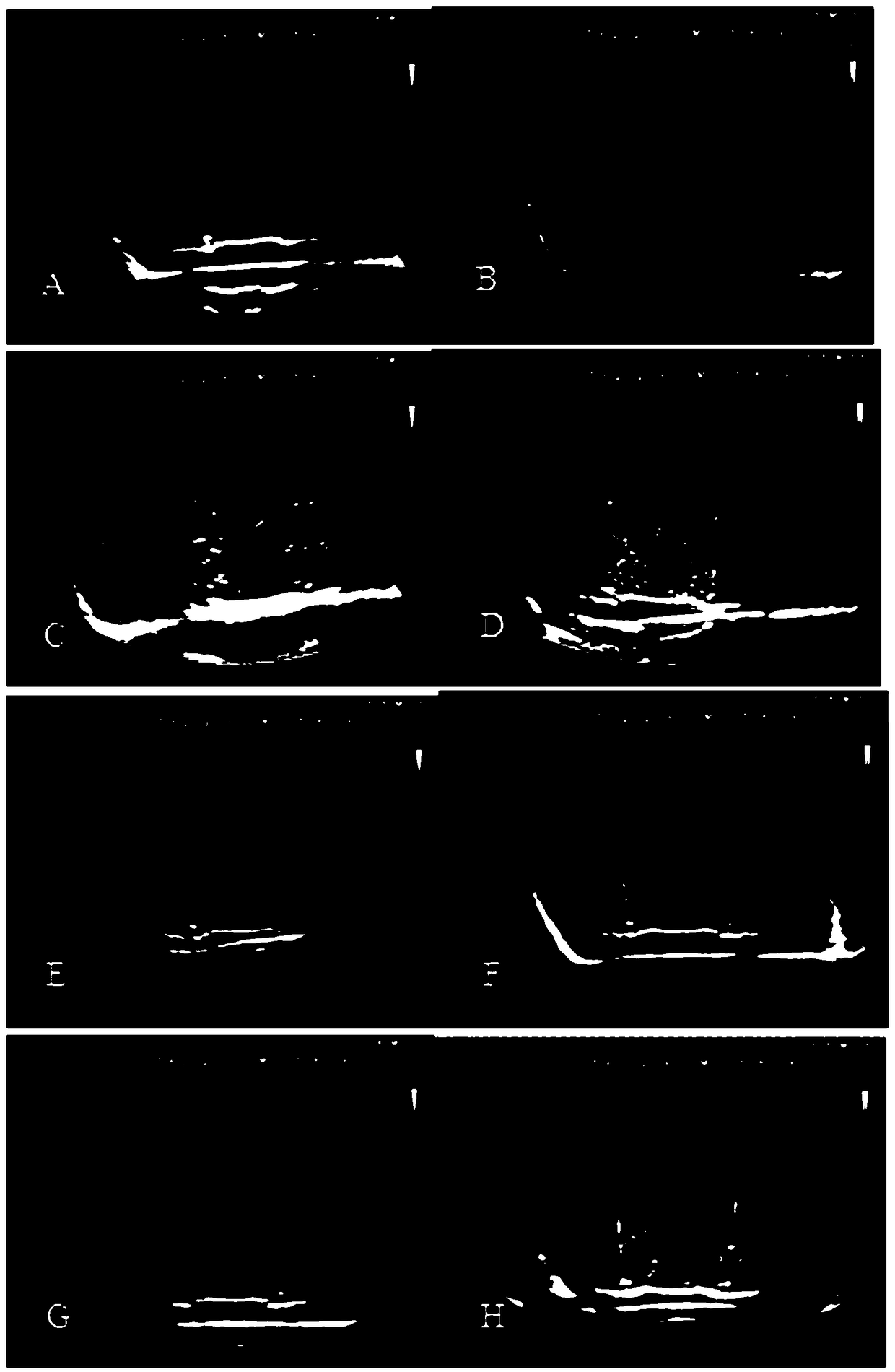 Instant oral liquid stomach ultrasonic developing agent formula and preparation method