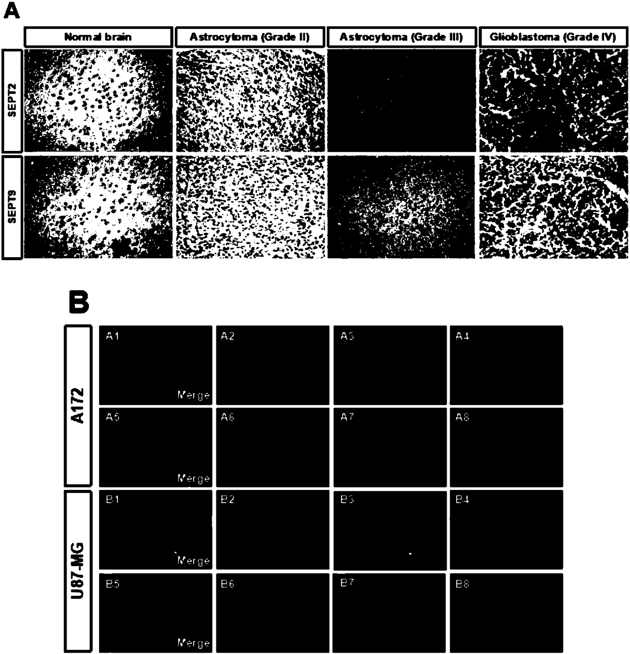 Application of septin gene shRNA in preparing septin gene activity inhibitor