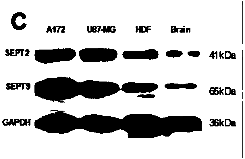 Application of septin gene shRNA in preparing septin gene activity inhibitor