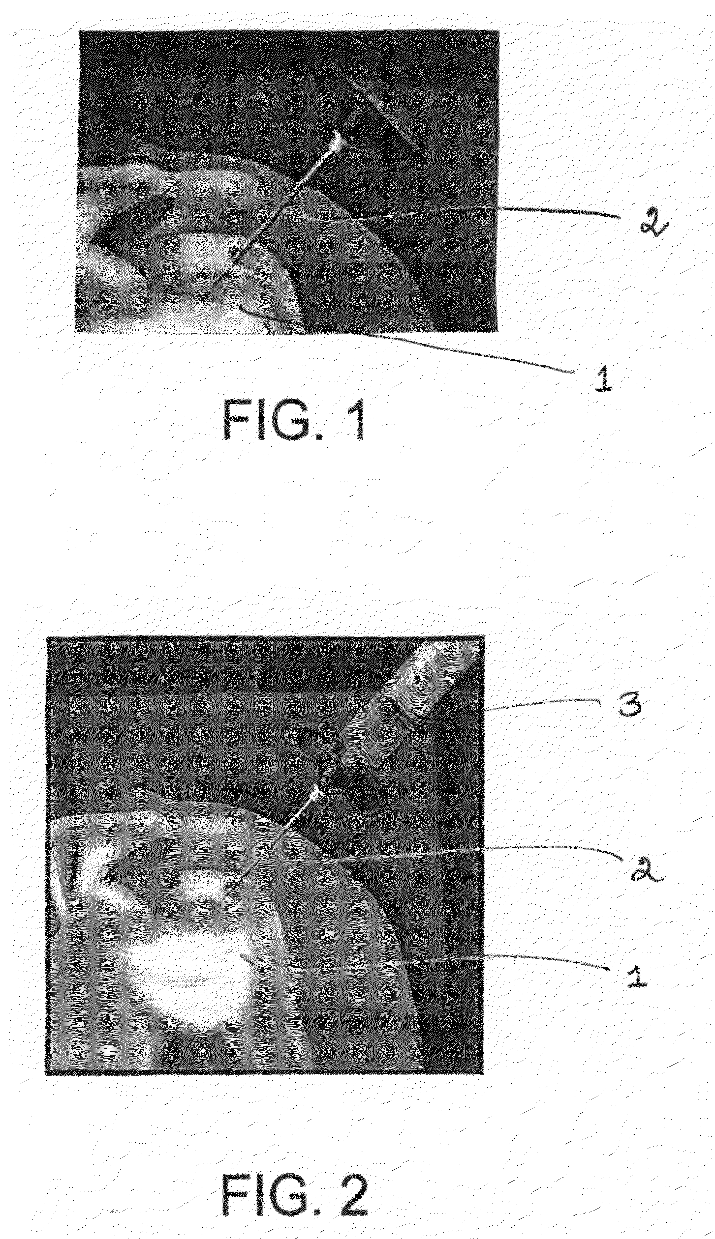 Arthroscopic harvesting and therapeutic application of bone marrow aspirate