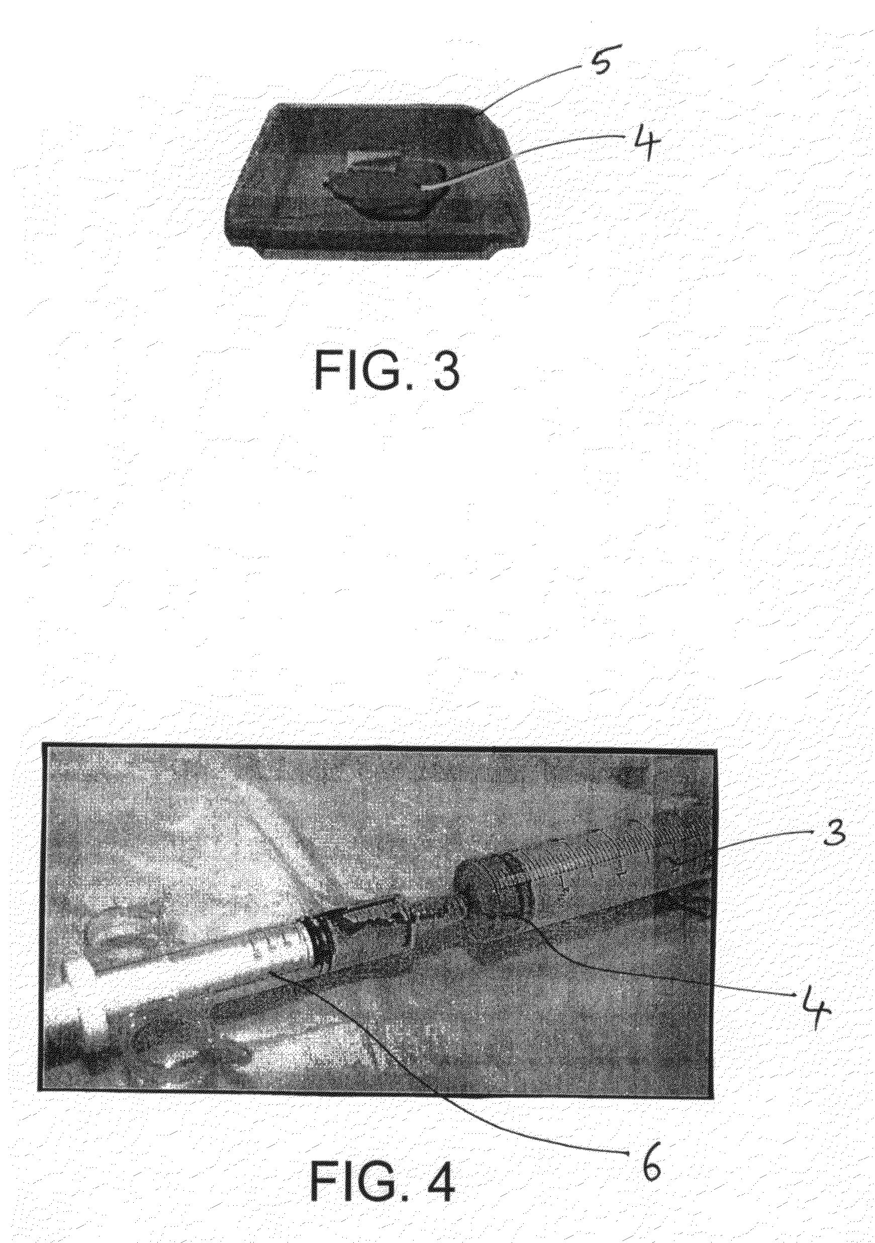 Arthroscopic harvesting and therapeutic application of bone marrow aspirate