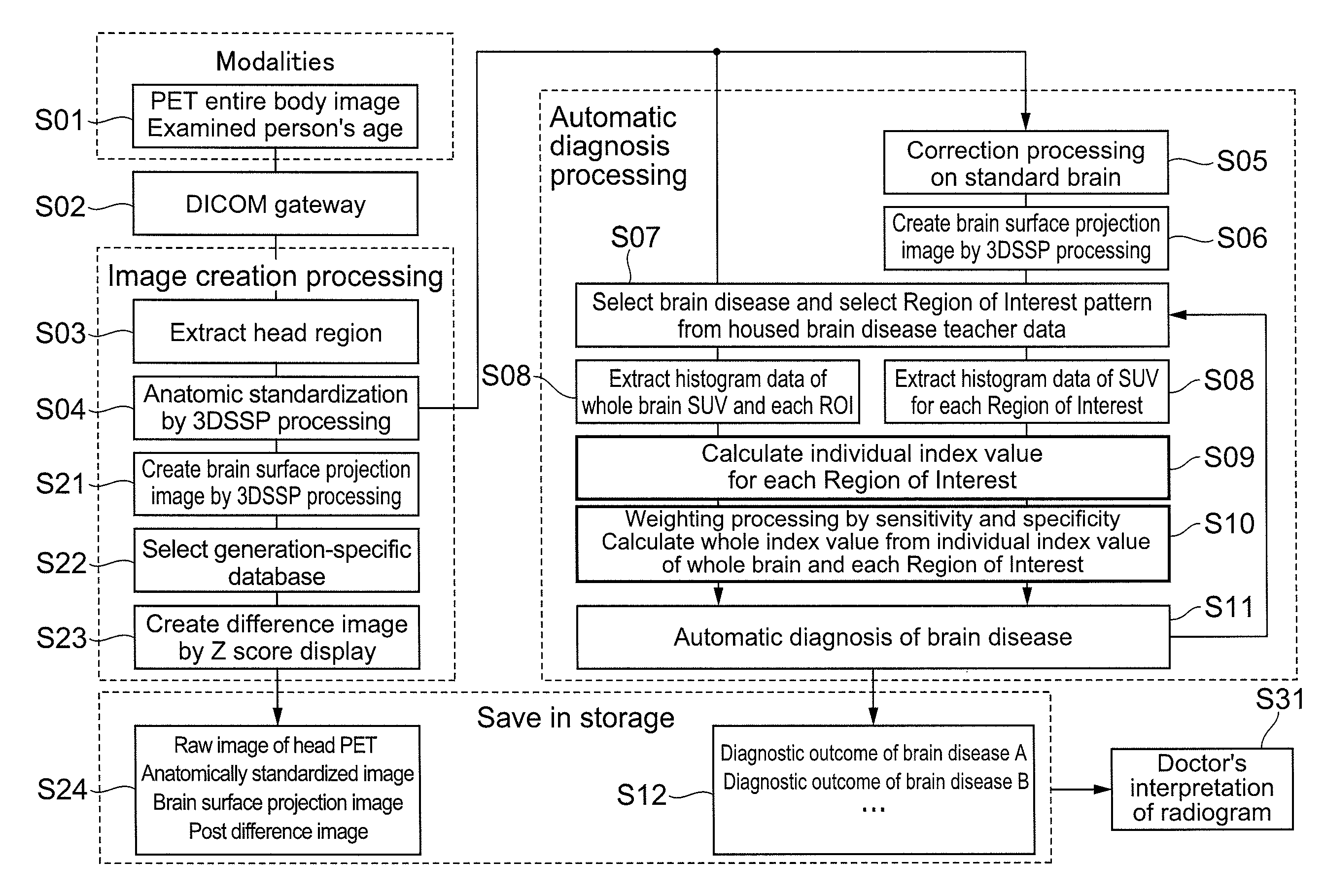 Brain disease diagnosis system