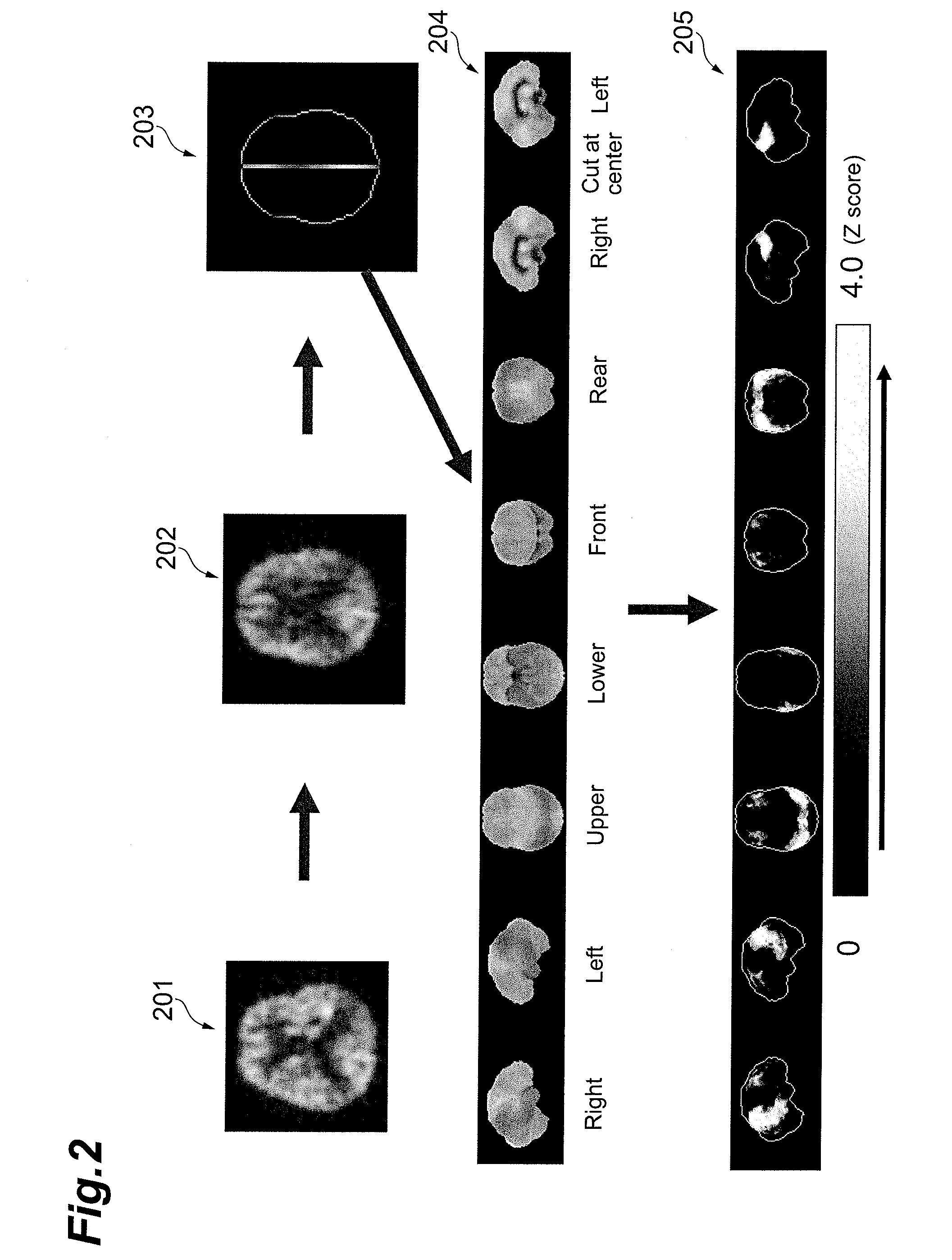 Brain disease diagnosis system