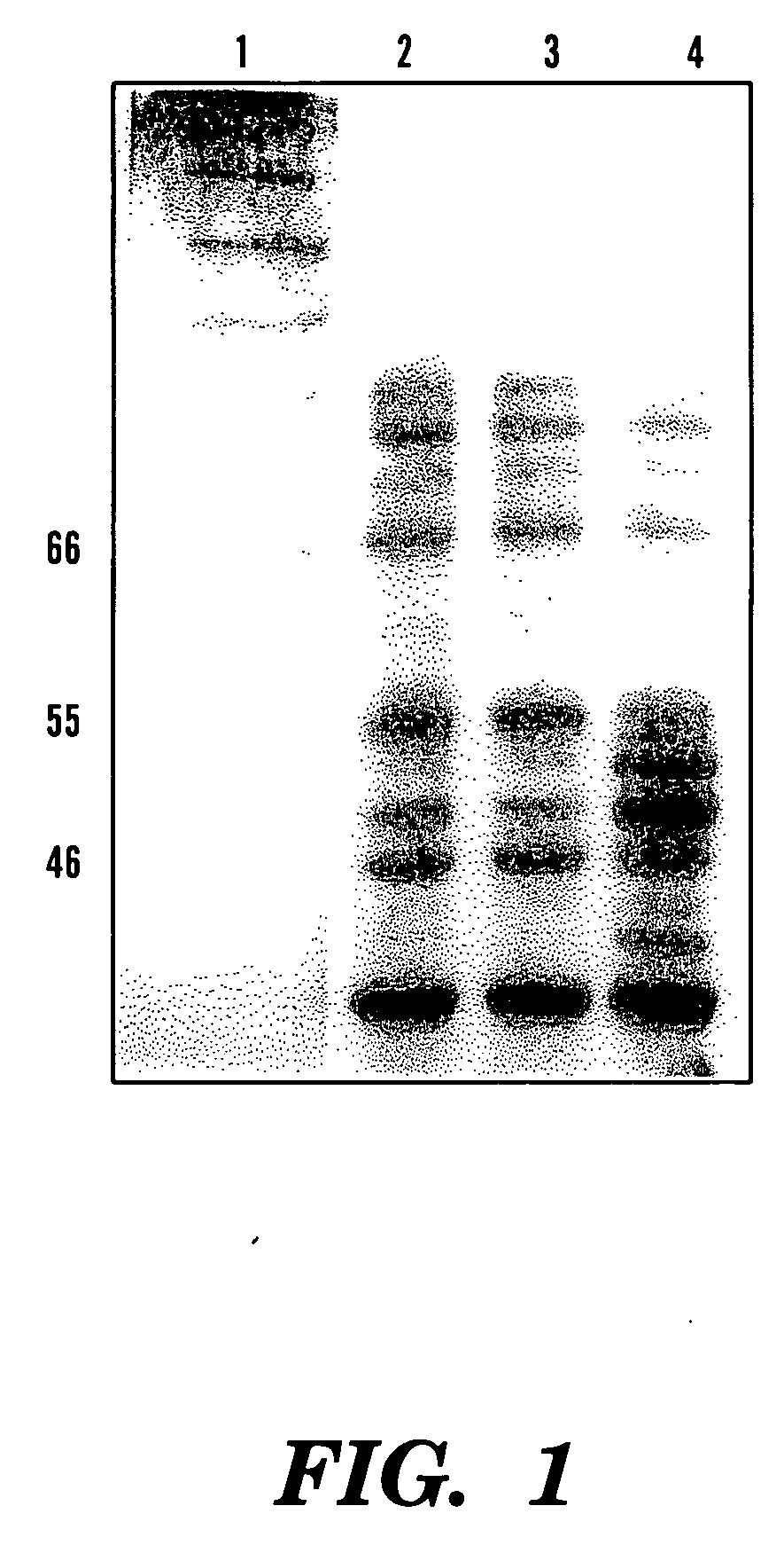 Overexpression of phytase genes in yeast systems