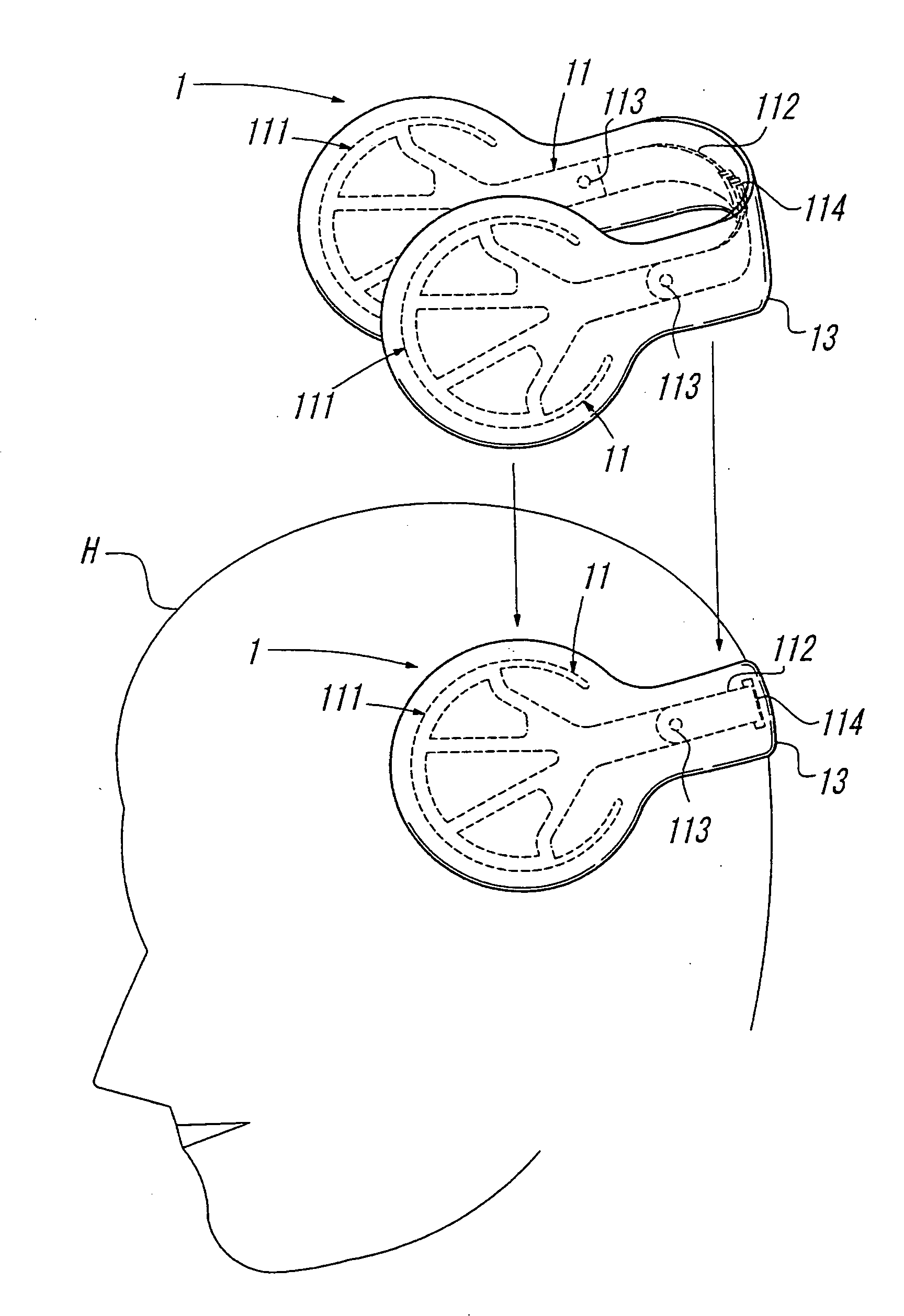 Head Orthosis