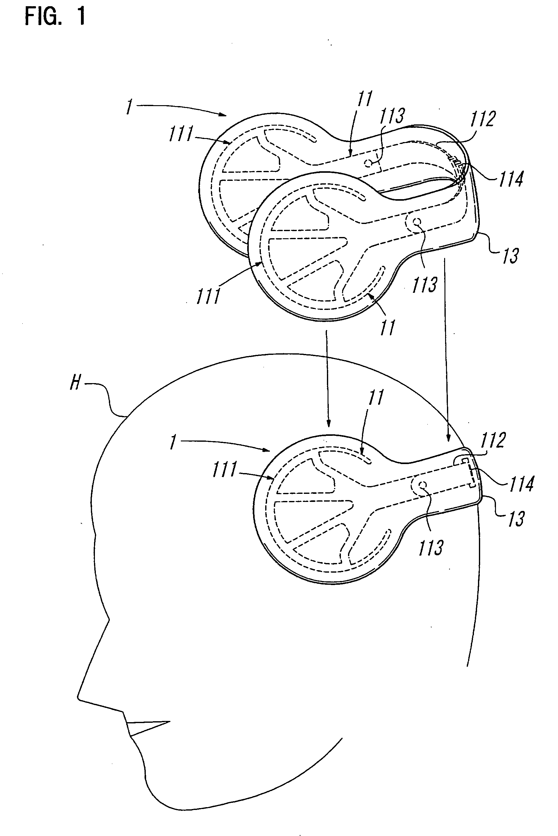 Head Orthosis