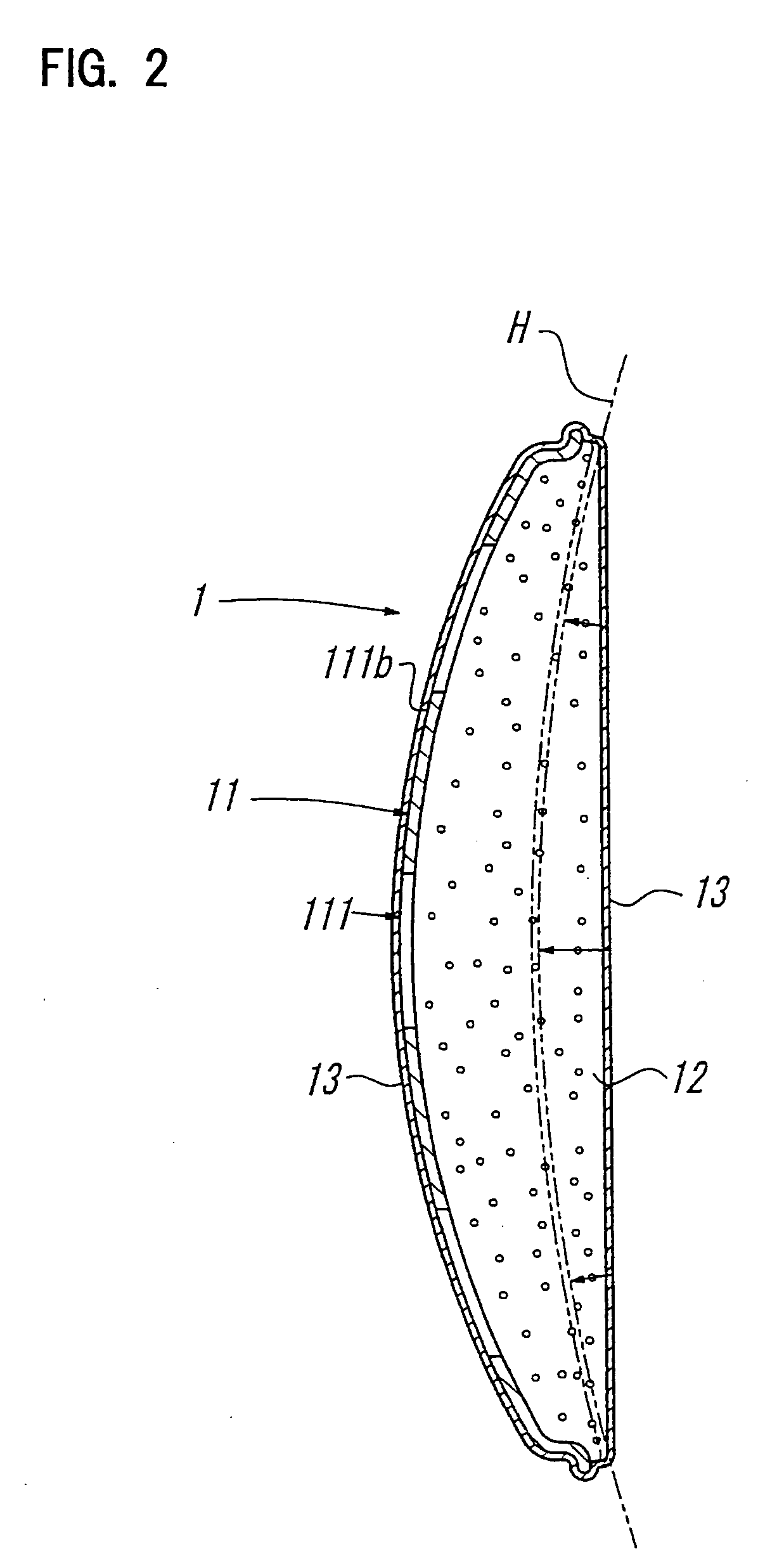 Head Orthosis