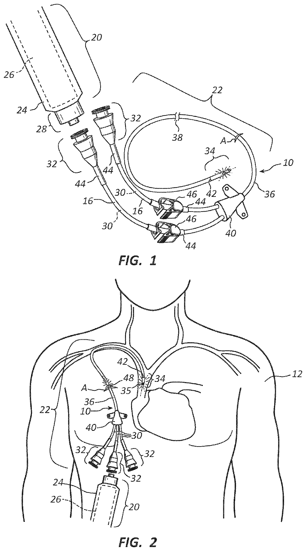 Methods and apparatus to deliver therapeutic, non-ultraviolet electromagnetic radiation versatilely via a catheter residing in a body cavity