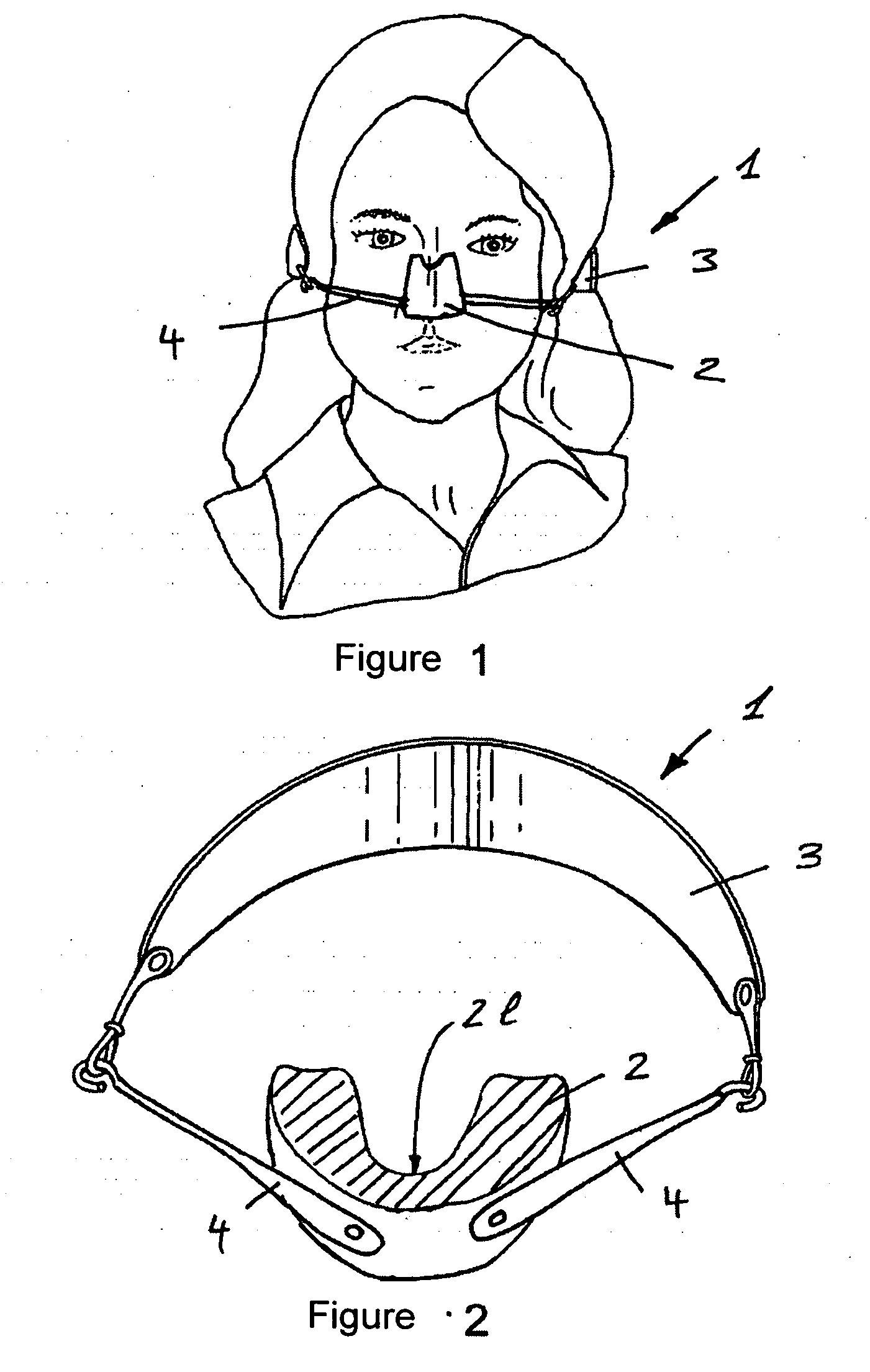 Device for reshaping bones