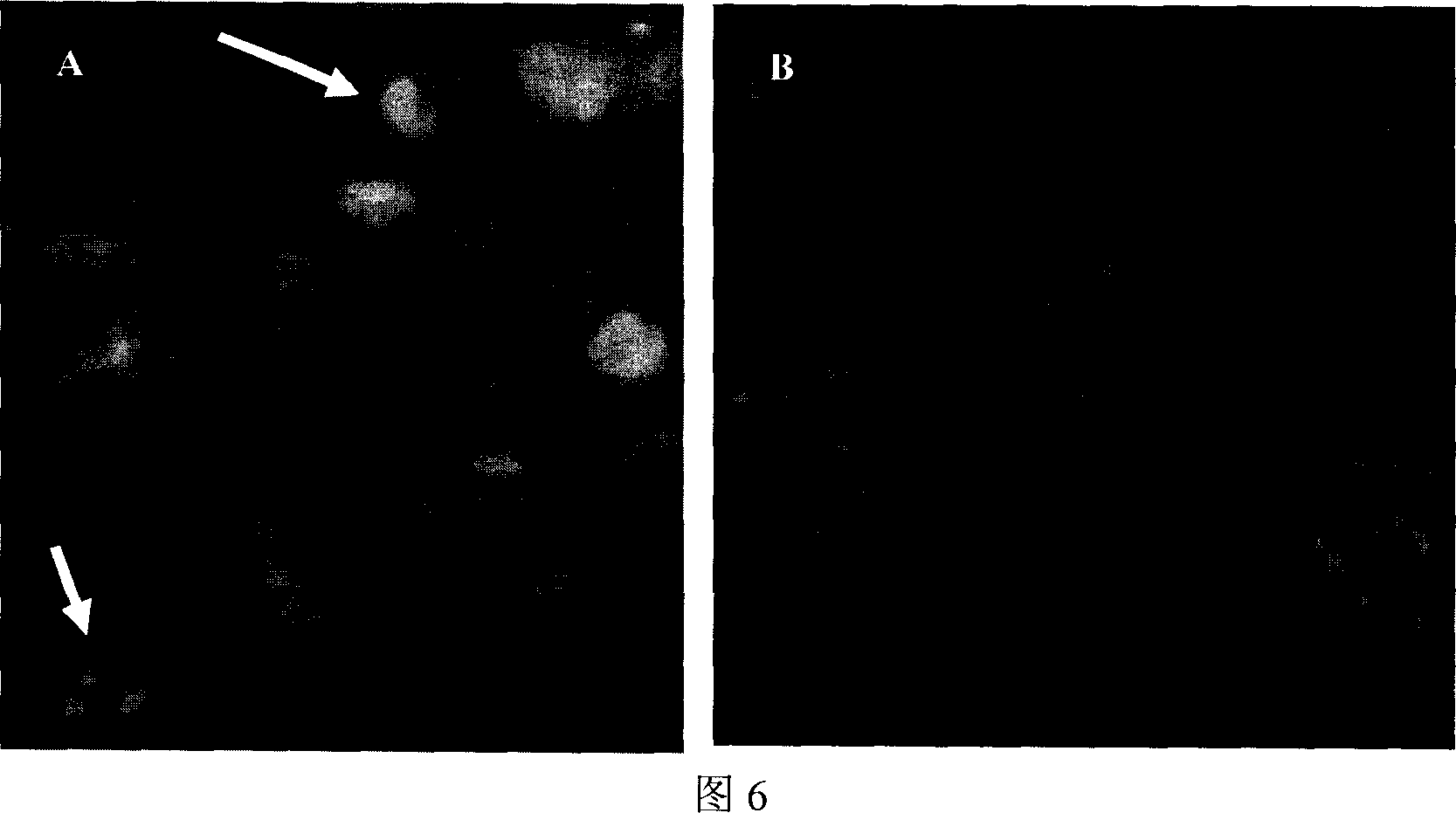 Human new gene LOC344967 correlated with nasopharyngeal carcinoma and coding protein product thereof