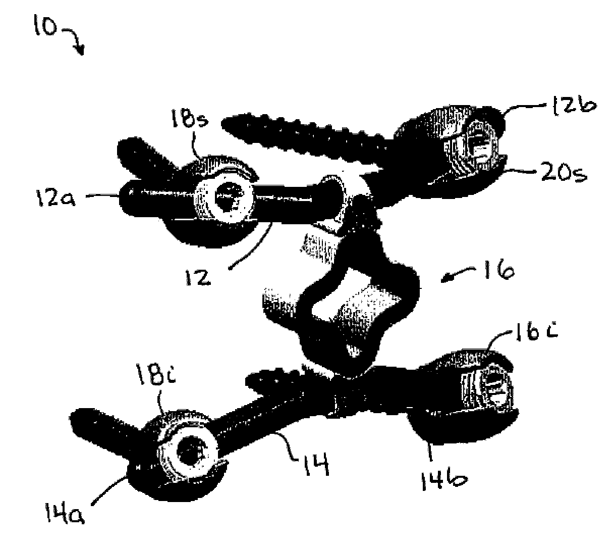 Posterior dynamic stabilization systems and methods