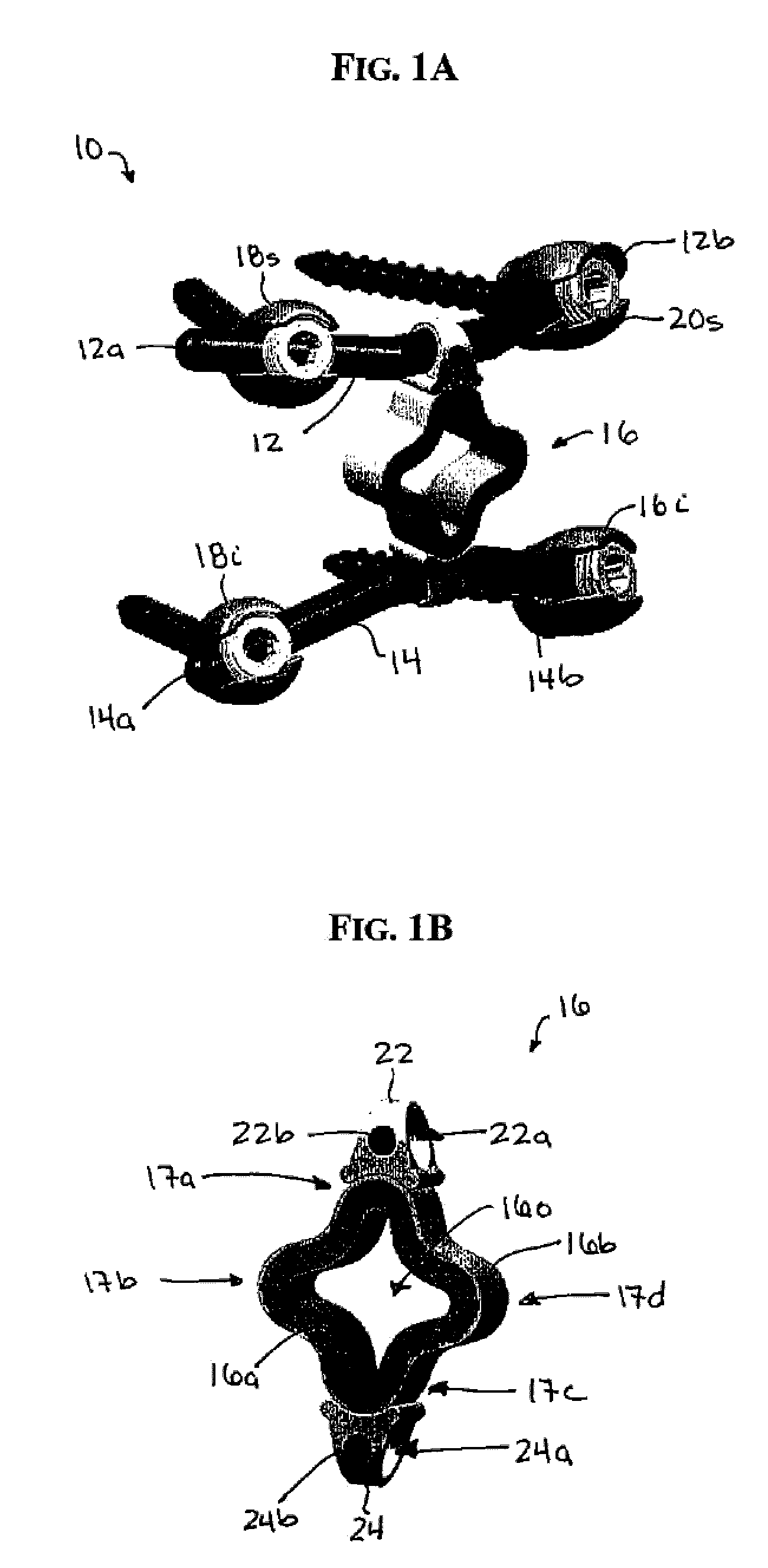 Posterior dynamic stabilization systems and methods