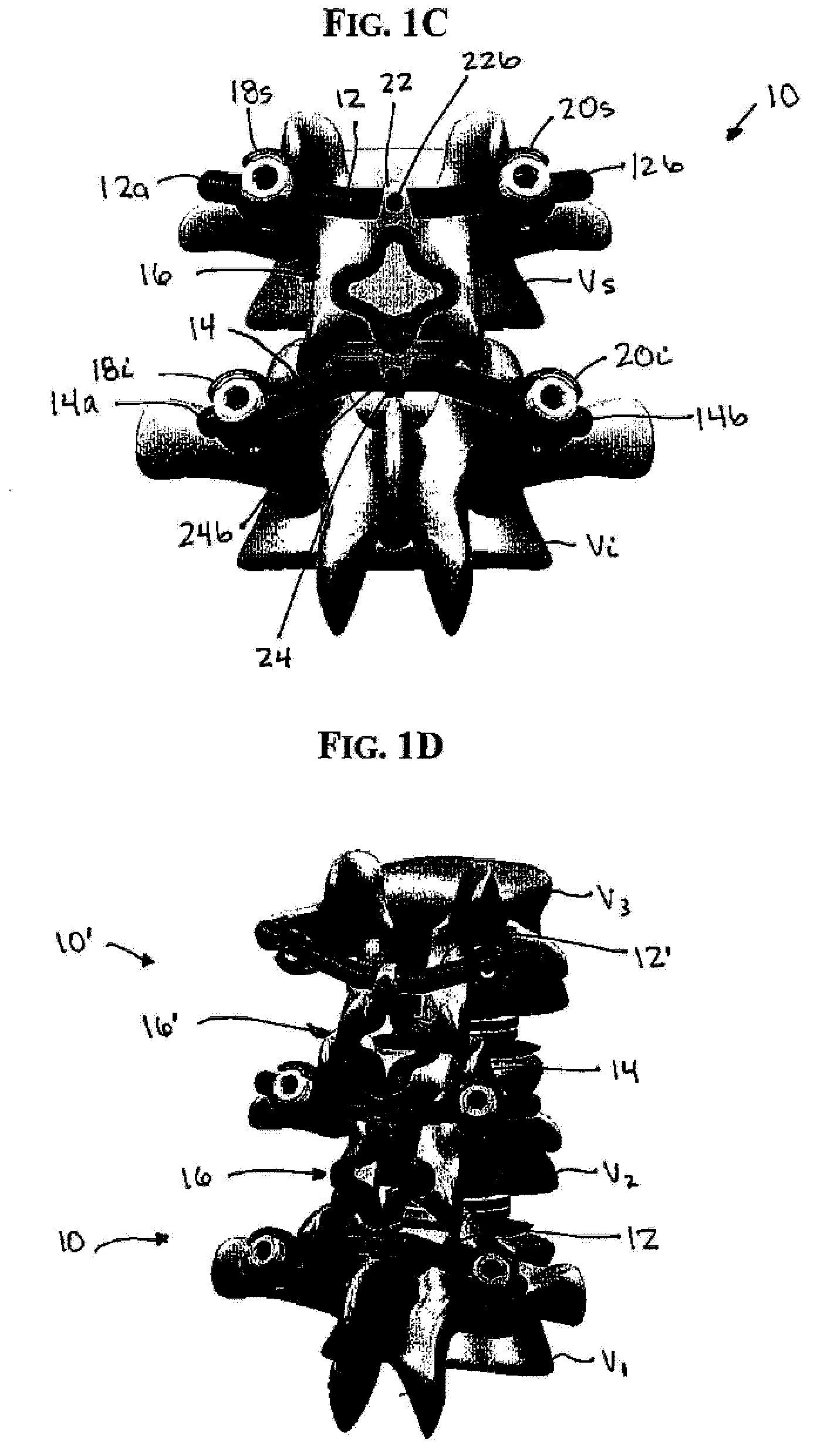 Posterior dynamic stabilization systems and methods