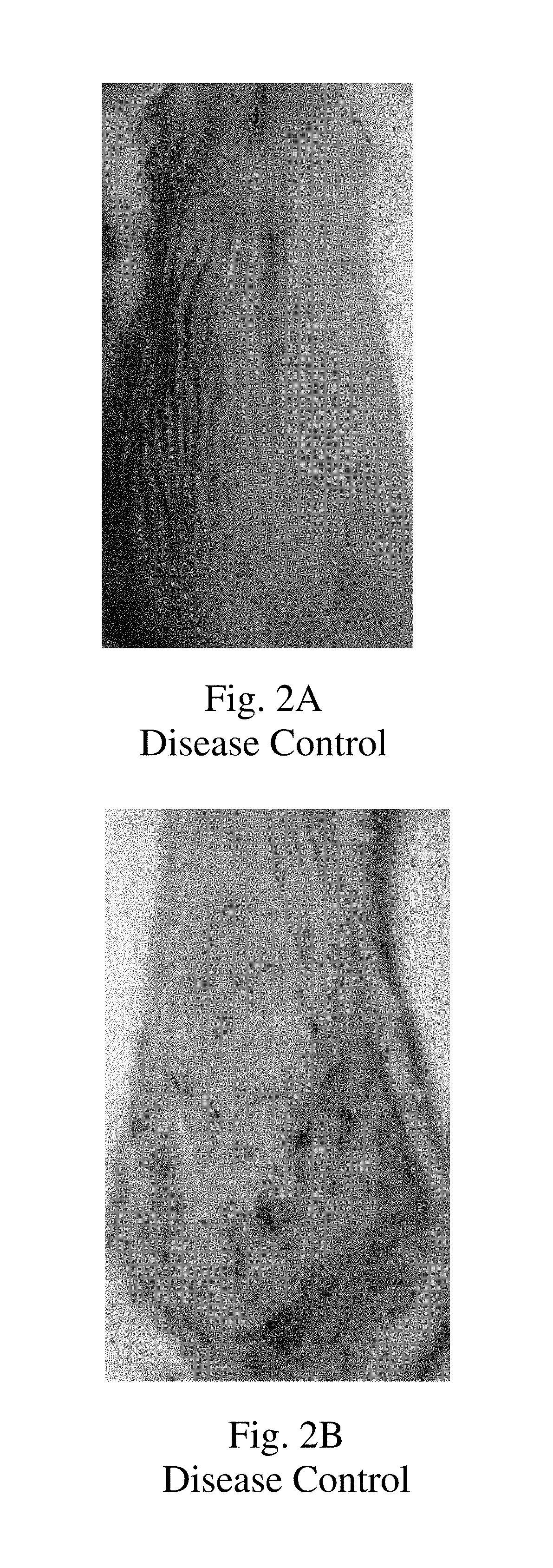 Topical montelukast for treatment of atopic dermatitis