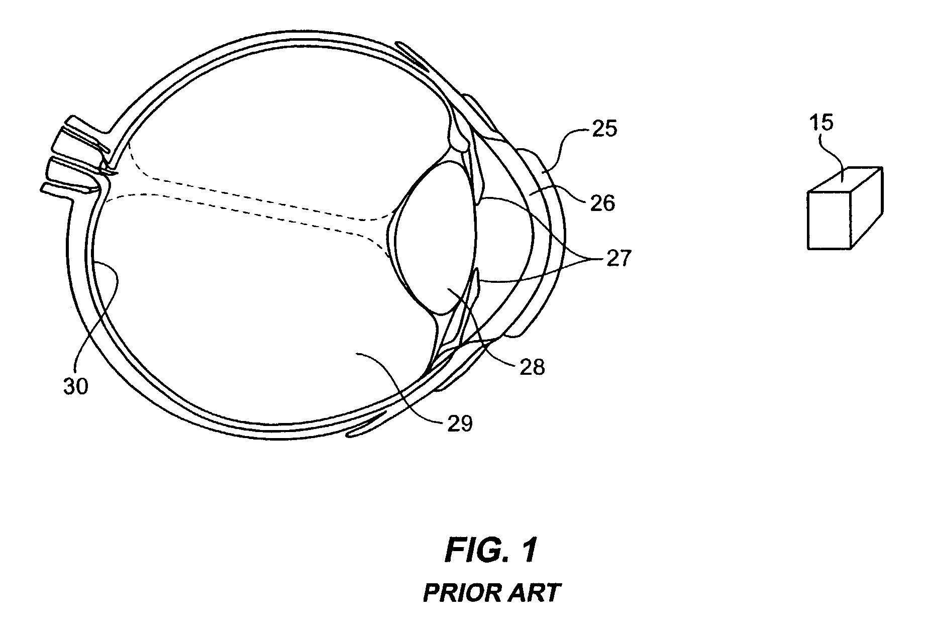 Extended depth of field optics for human vision