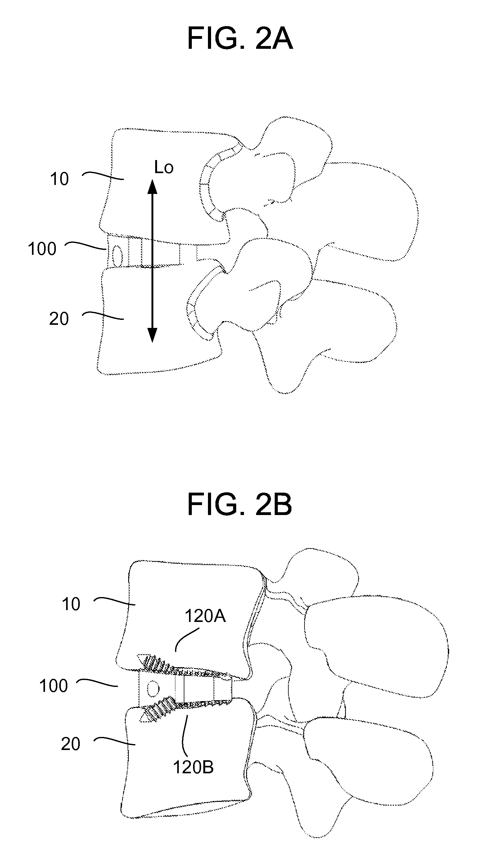 Insertion tool for Inter-body Vertebral Prosthetic Device With Self-Deploying Screws