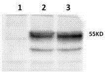 Anti-human B7-H4 extracellular monoclonal antibody secreting hybridoma cell strain, anti-human B7-H4 monoclonal antibody and application thereof