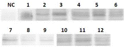 Anti-human B7-H4 extracellular monoclonal antibody secreting hybridoma cell strain, anti-human B7-H4 monoclonal antibody and application thereof