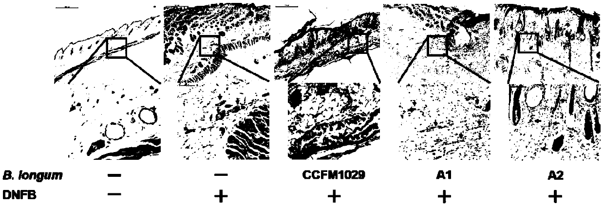 Bifidobacterium longum capable of relieving atopic dermatitis and application thereof