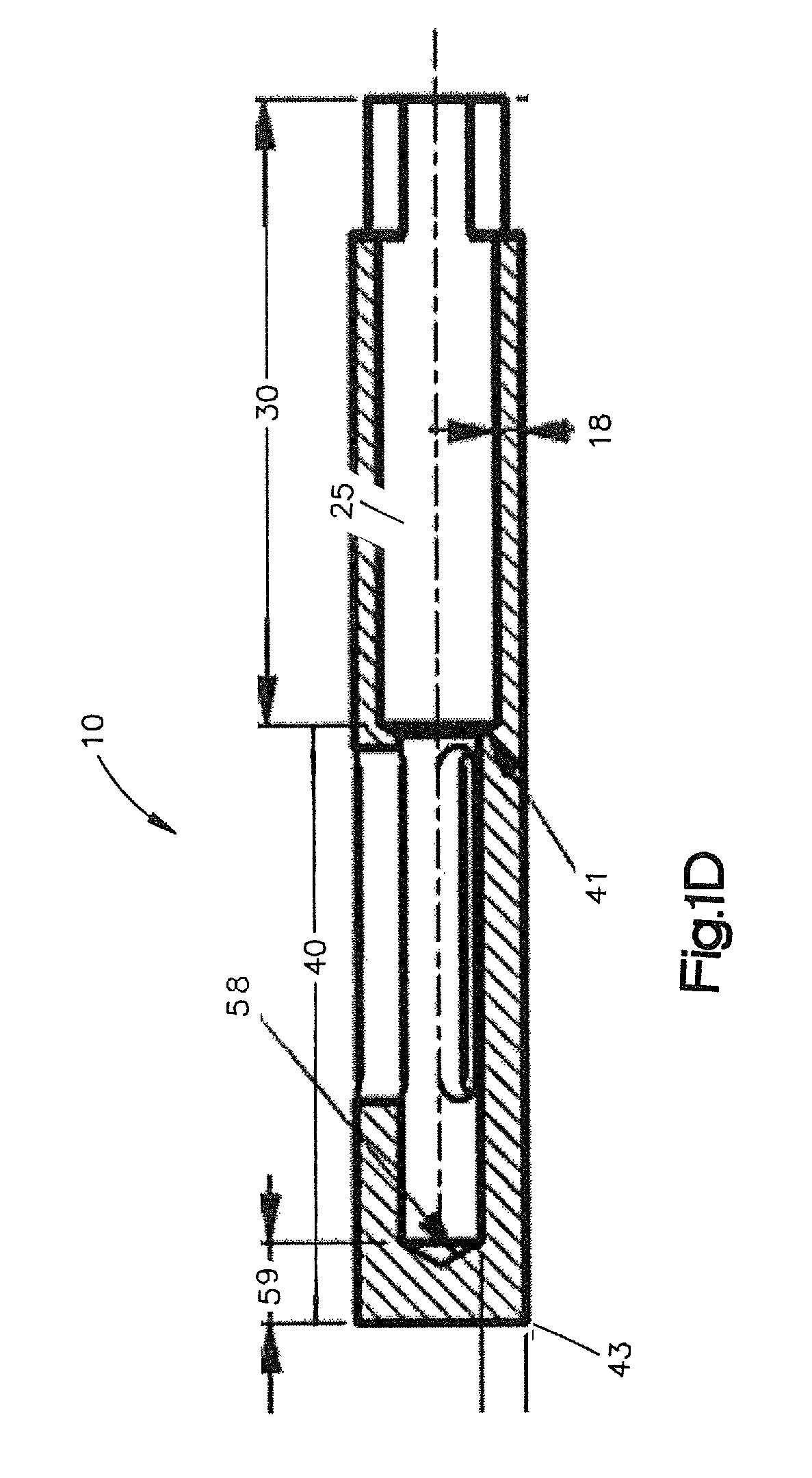 Allograft bone plugs, systems and techniques