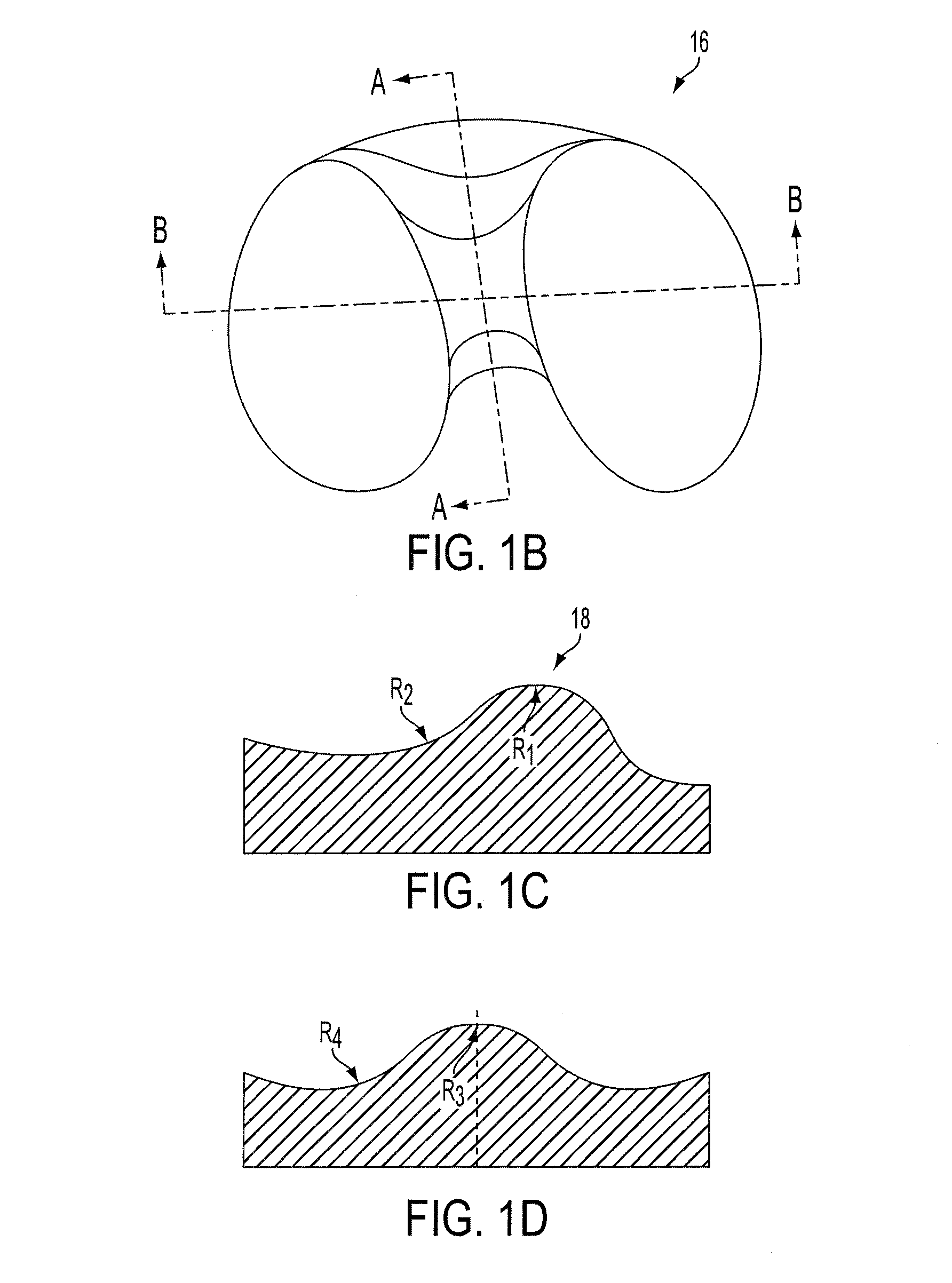 Methods and devices for knee joint replacement with anterior cruciate ligament substitution