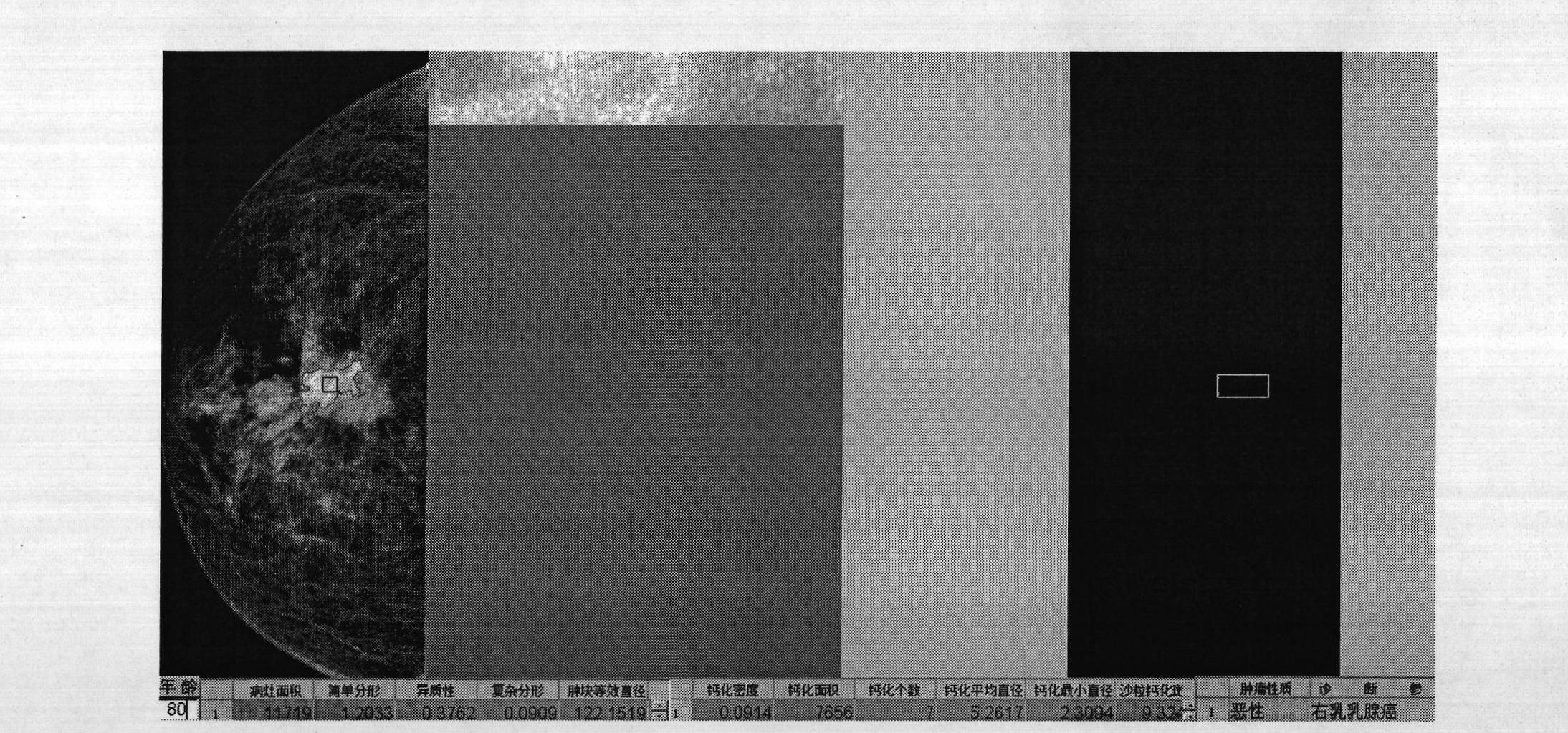 Breast mass and calcific benign-malignant automatic recognition and quantitative image evaluation system