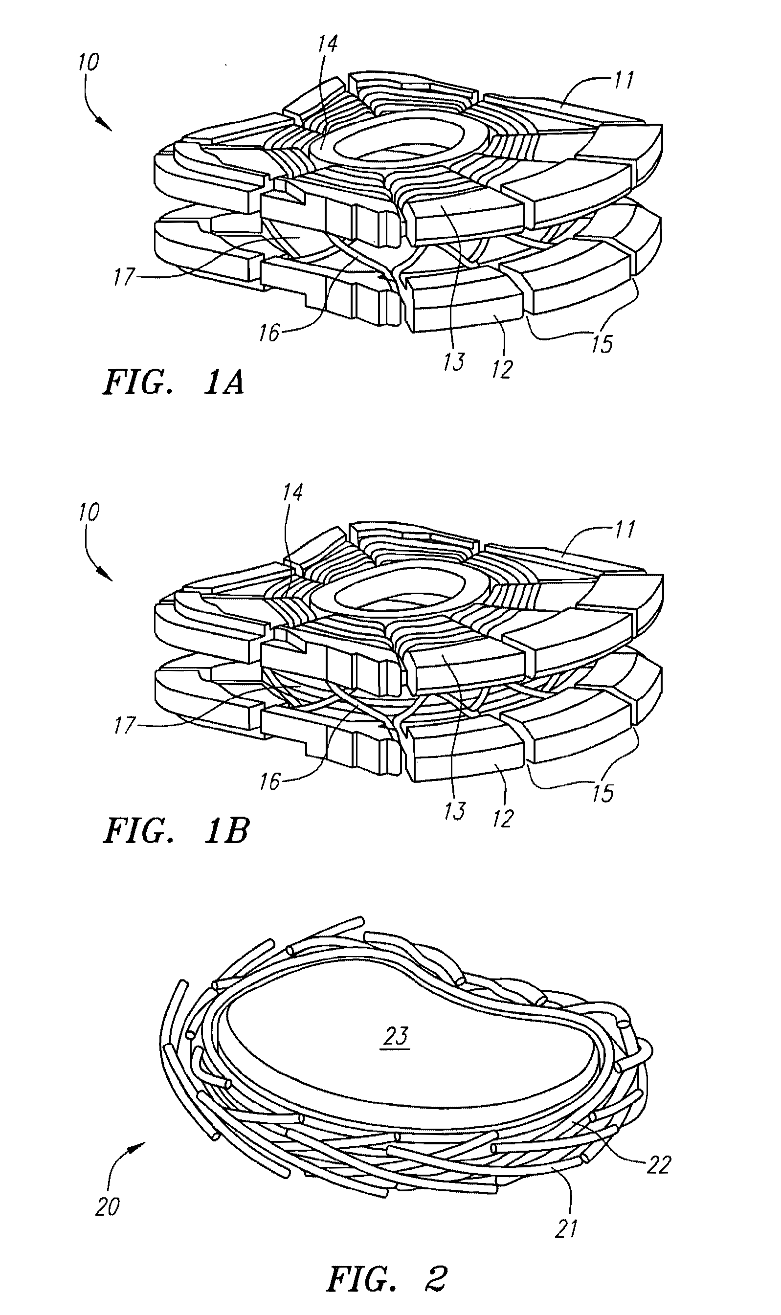 Prosthetic Intervertebral Discs