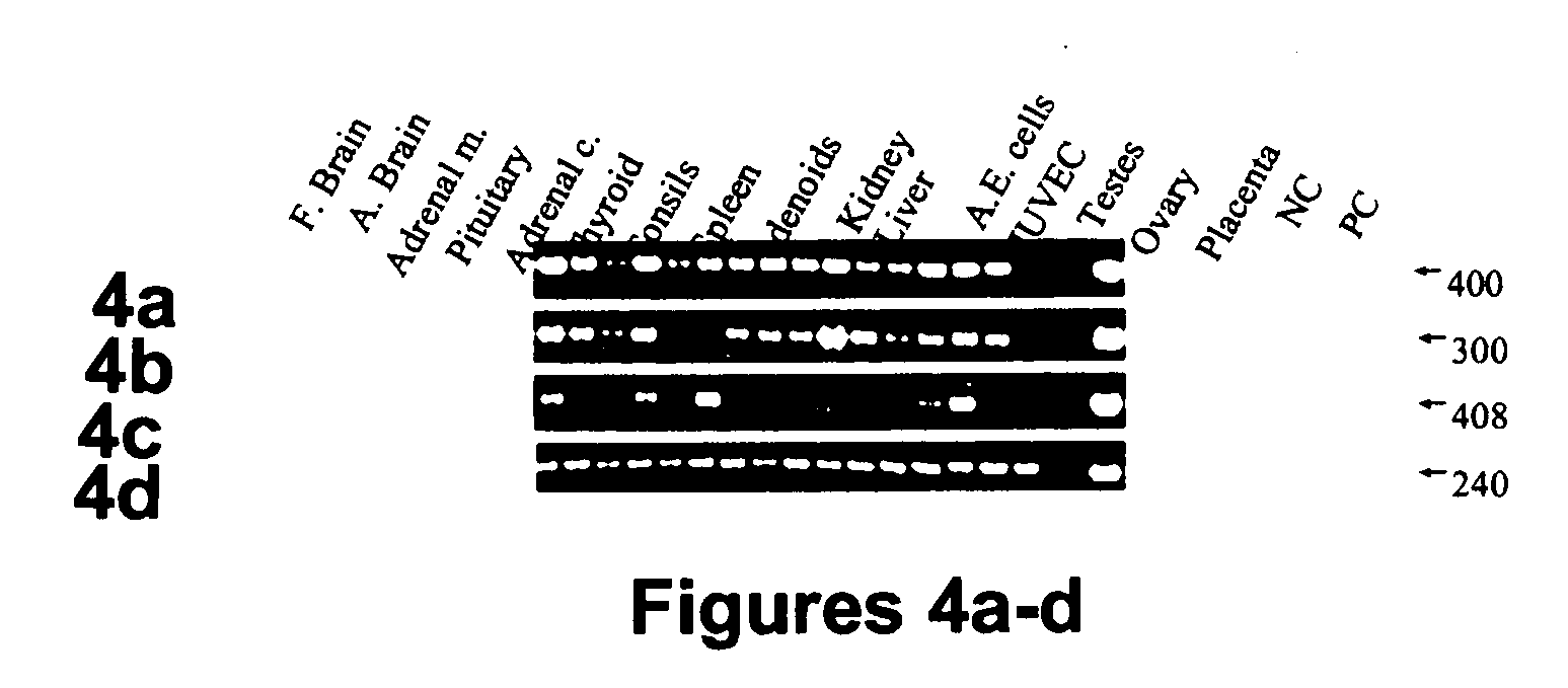 Human Sef isoforms and methods of using same for cancer gene therapy