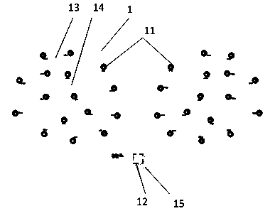 Breast monitoring early warning system based on NB-IOT and monitoring method thereof