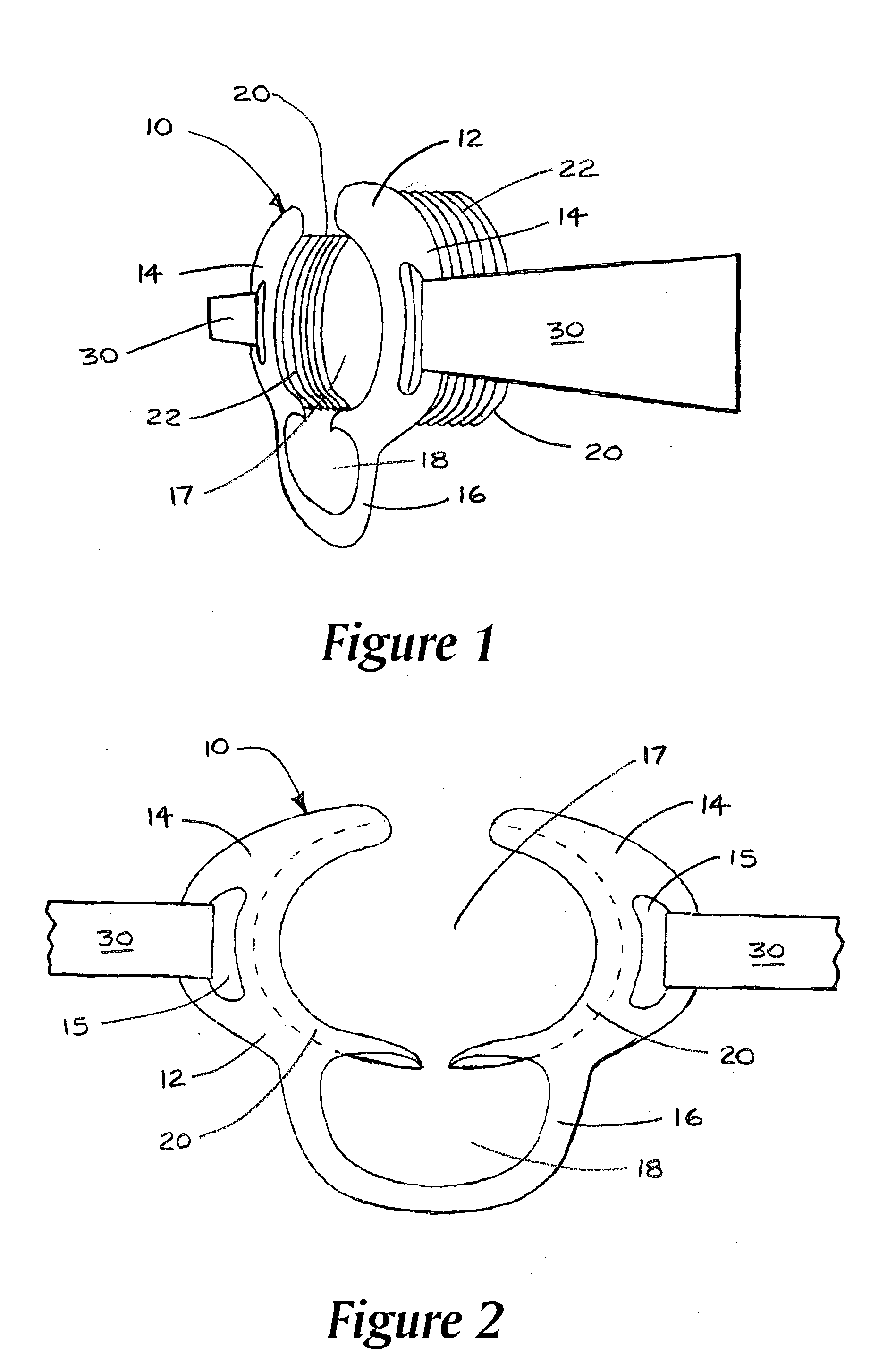 Mandibular occlusal inhibitor