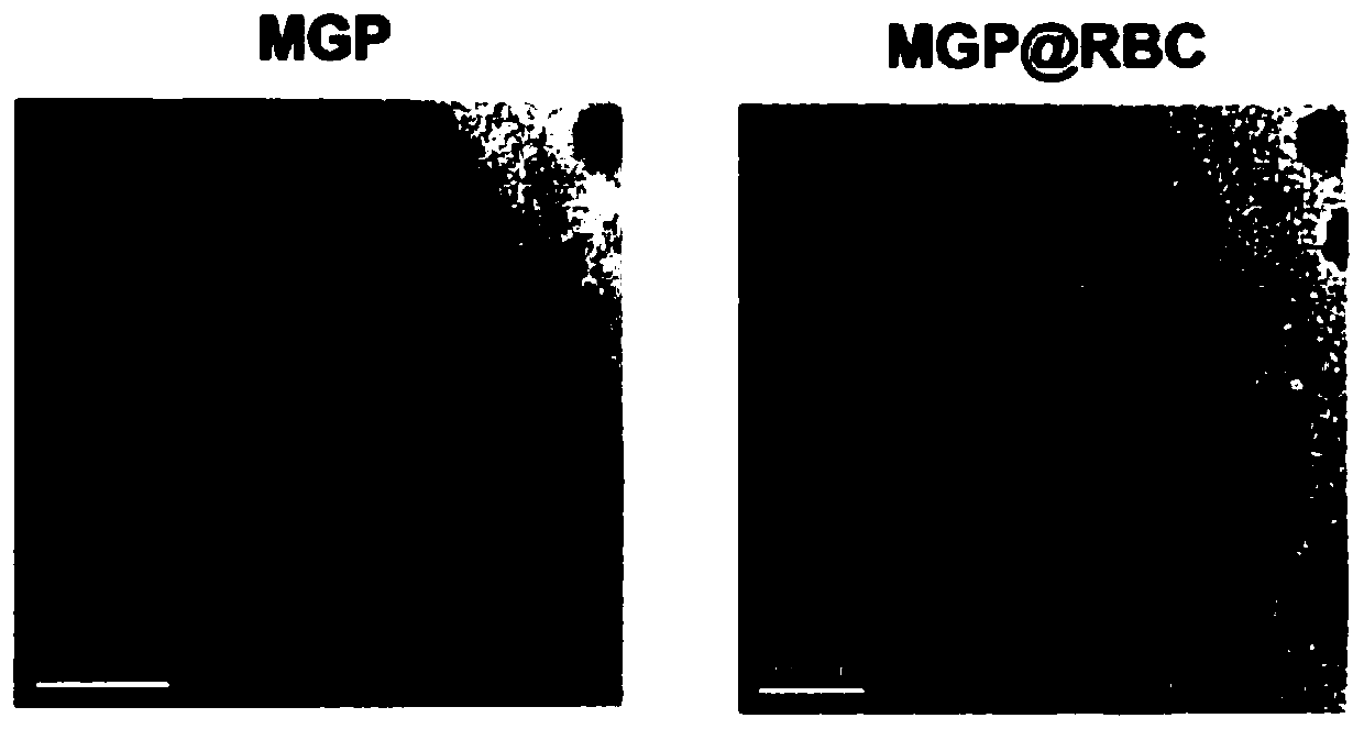 Biomimetic nanoparticles for gas production and anti-tumor activity catalyzed by bioenzymes and preparation method thereof