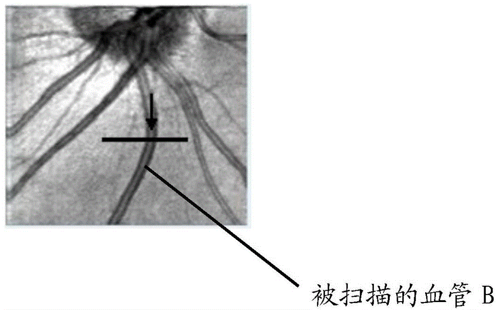 Device and method for measuring blood flow of blood vessels